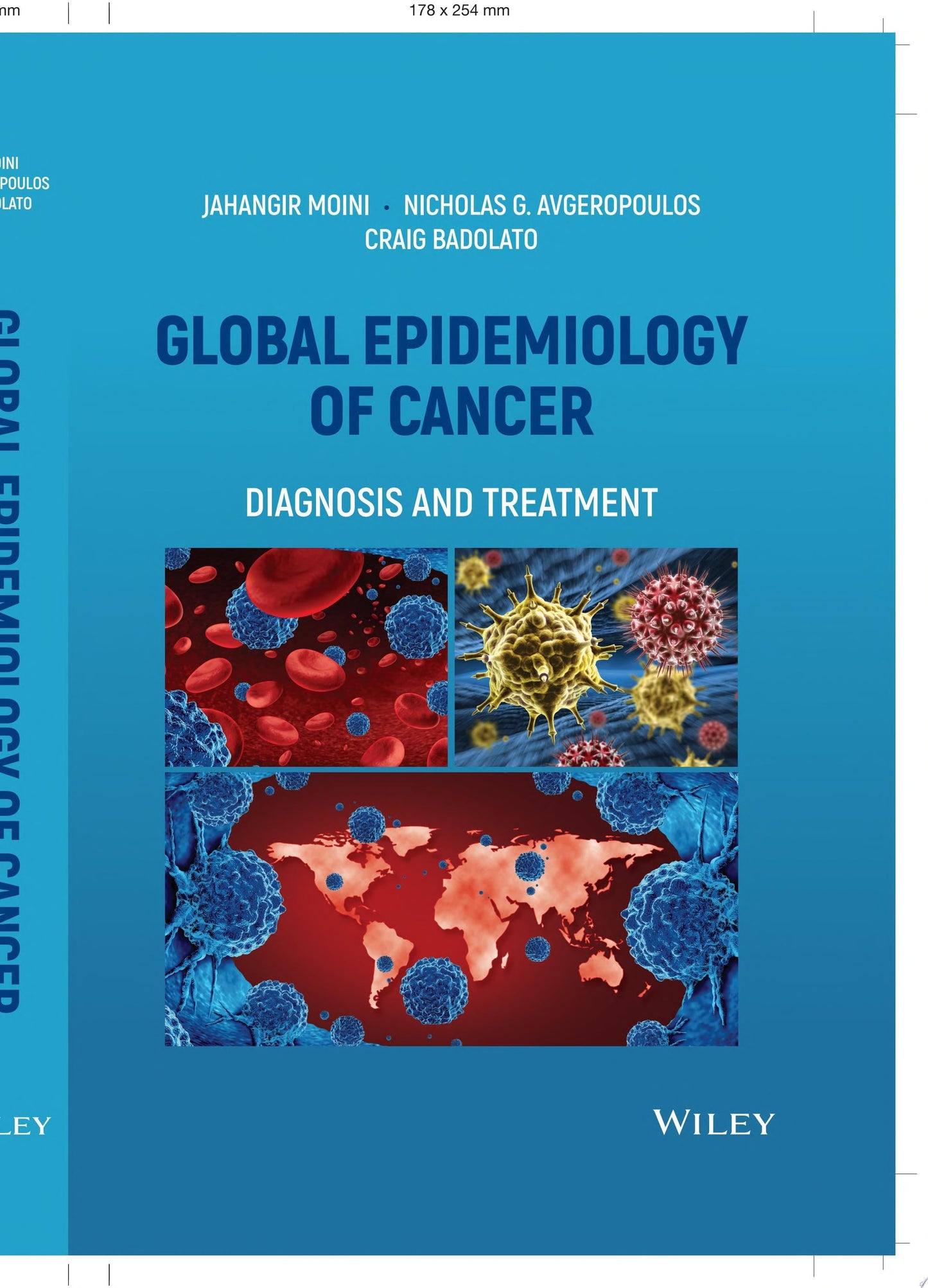 Global Epidemiology of Cancer: Diagnosis and Treatment