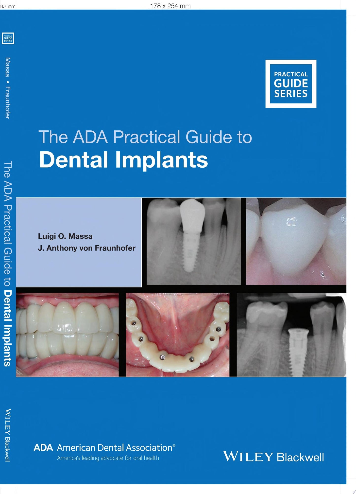 The ADA Practical Guide to Dental Implants