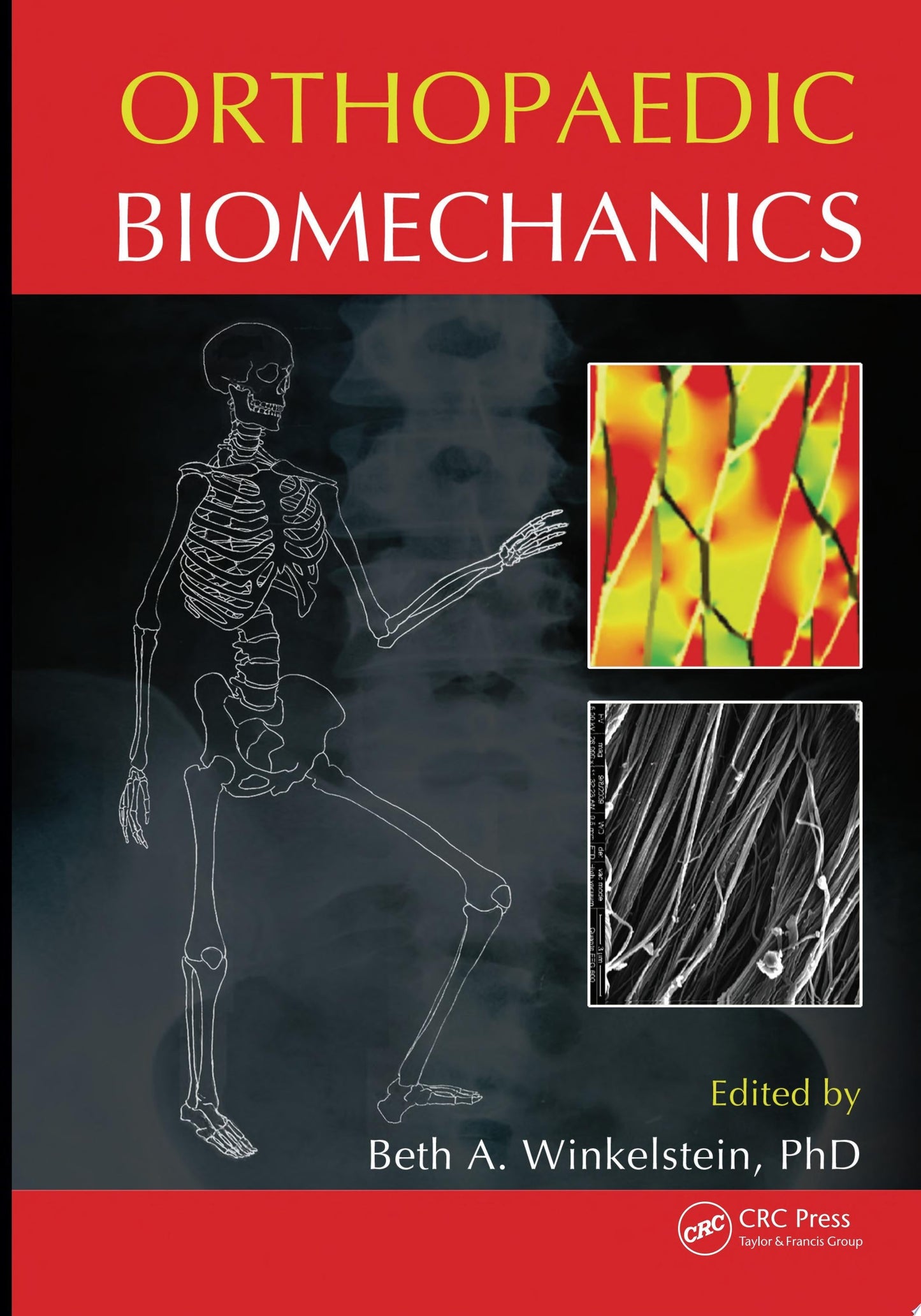 Meniscus Injuries, An Issue of Clinics in Sports Medicine (Volume 39-1) (The Clinics: Orthopedics, Volume 39-1)