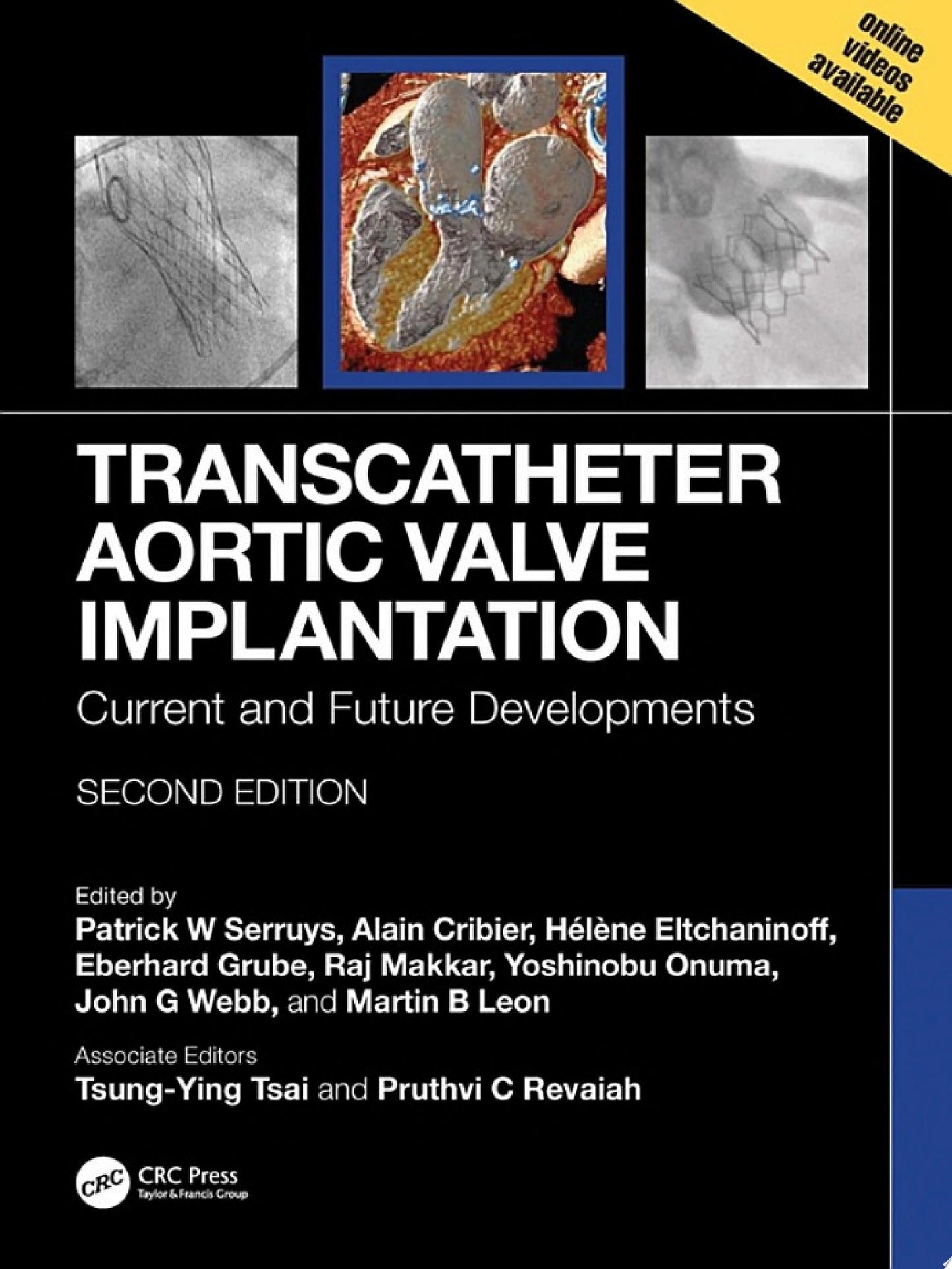 Transcatheter Aortic Valve Implantation: Current and Future Developments, 2nd edition