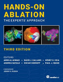 Hands-On Ablation: The Experts’ Approach, Third Edition