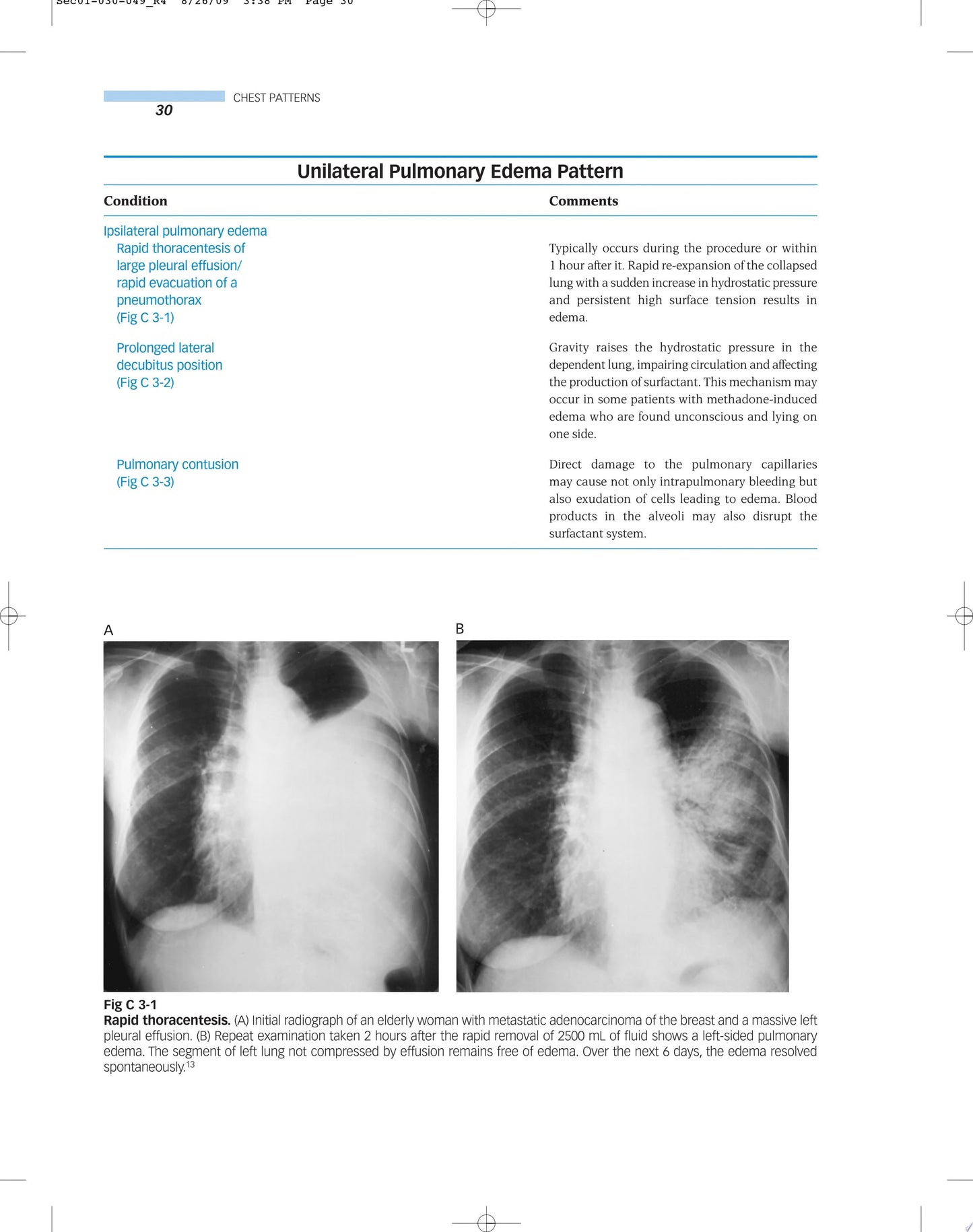 Musculoskeletal Imaging Companion, 2nd Edition