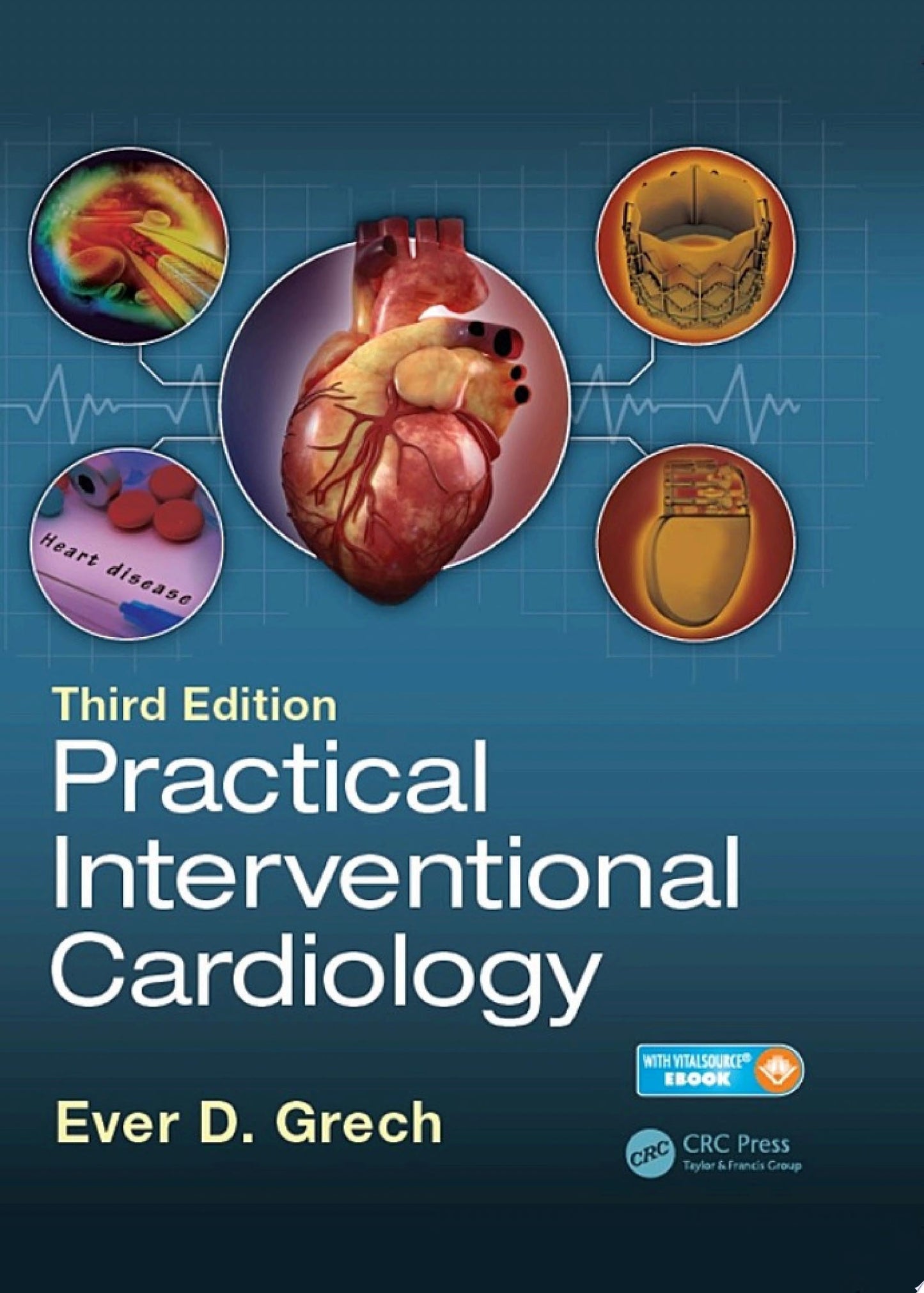 Practical Interventional Cardiology: Third Edition