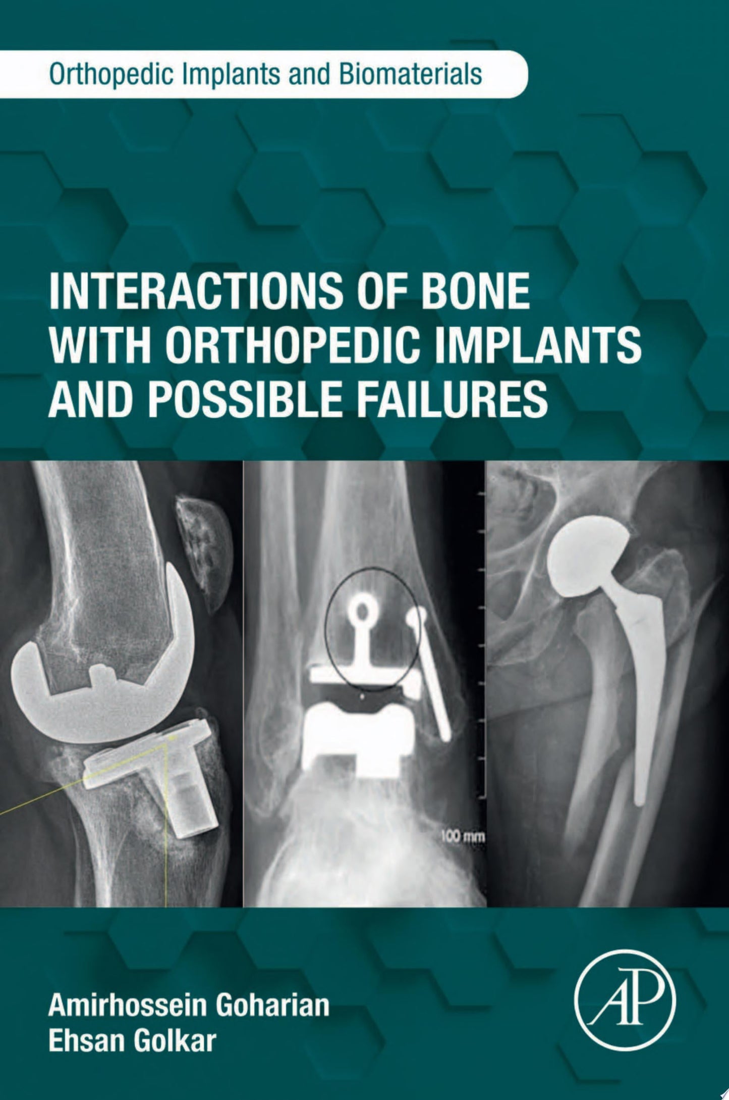 Interactions of Bone with Orthopedic Implants and Possible Failures