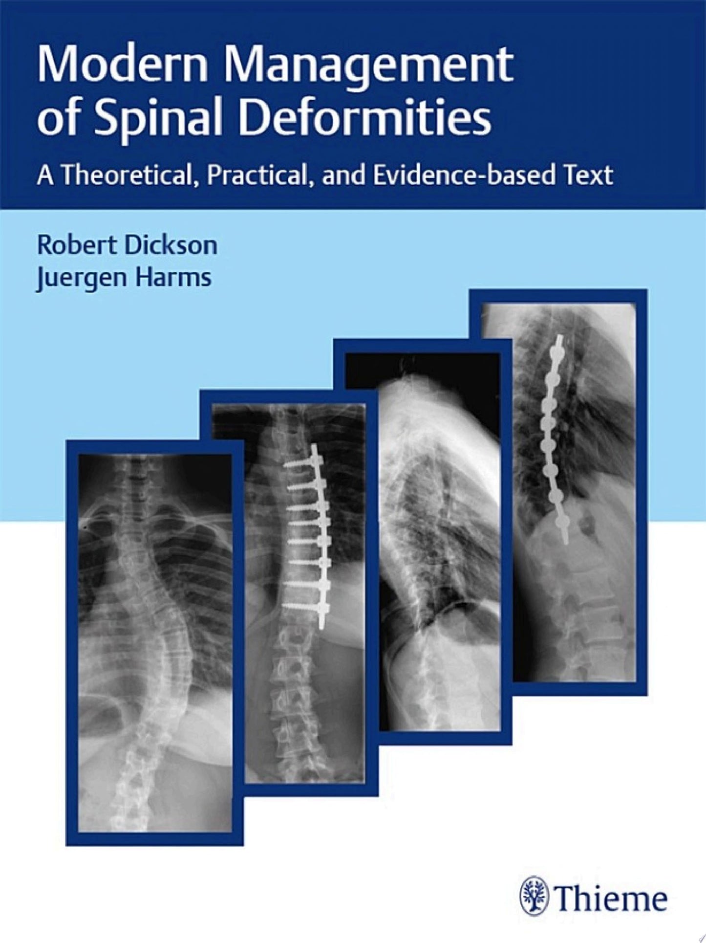 Modern Management of Spinal Deformities: A Theoretical, Practical, and Evidence-based Text