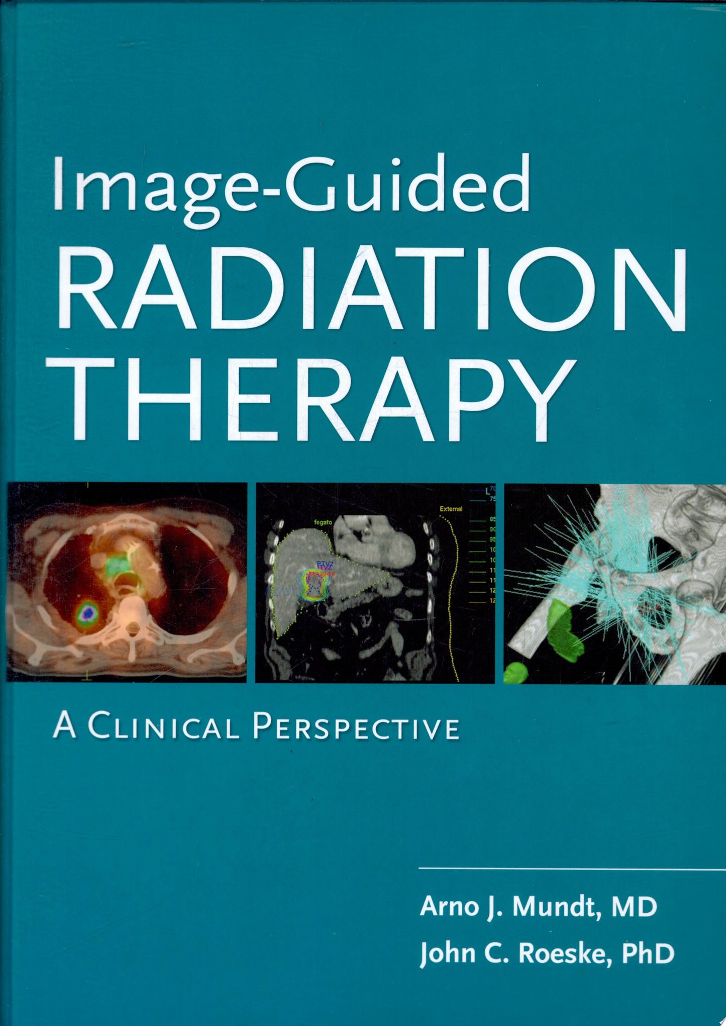 Image-Guided Radiation Therapy: A Clinical Perspective
