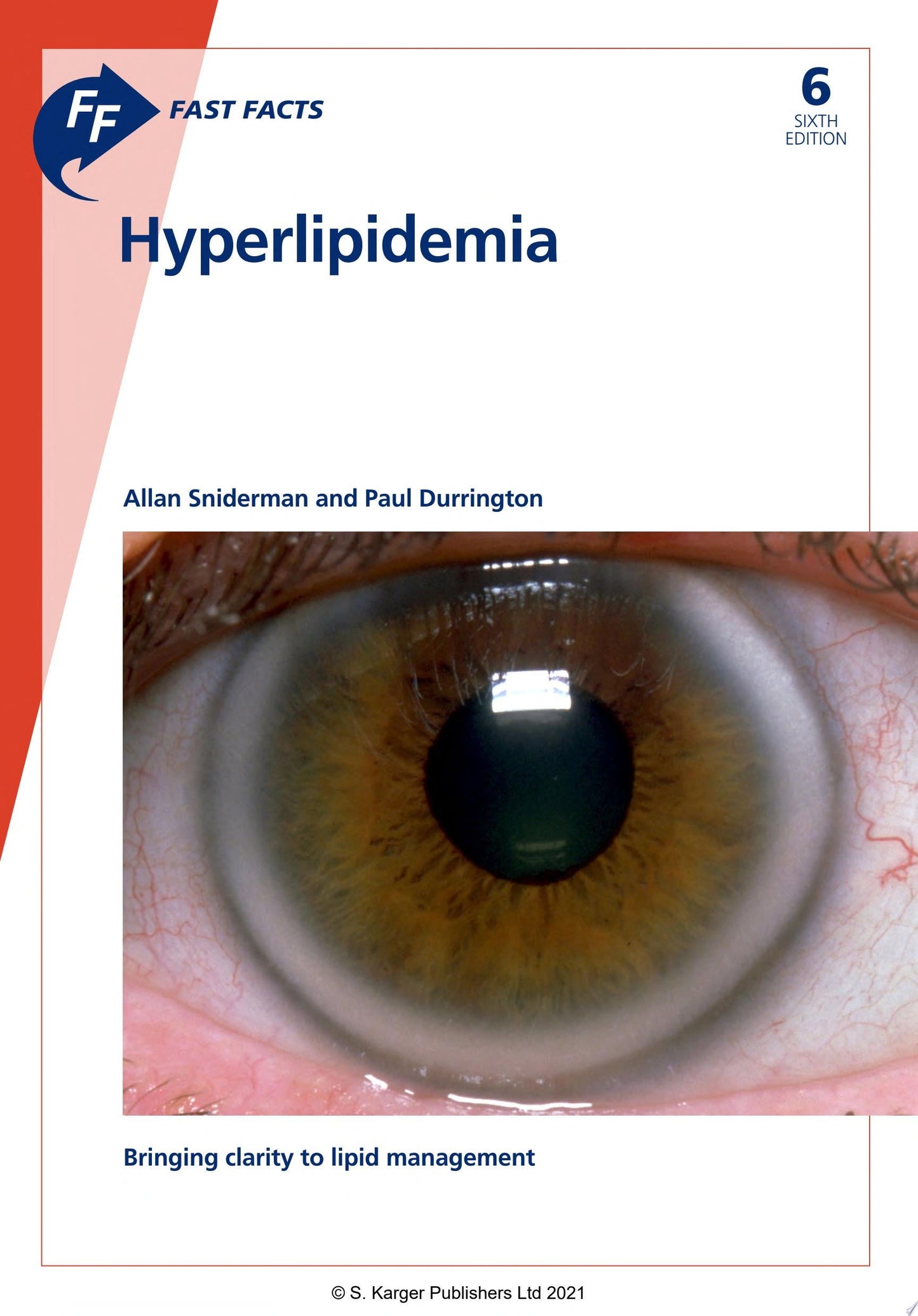 Fast Facts: Hyperlipidemia, 6th Edition