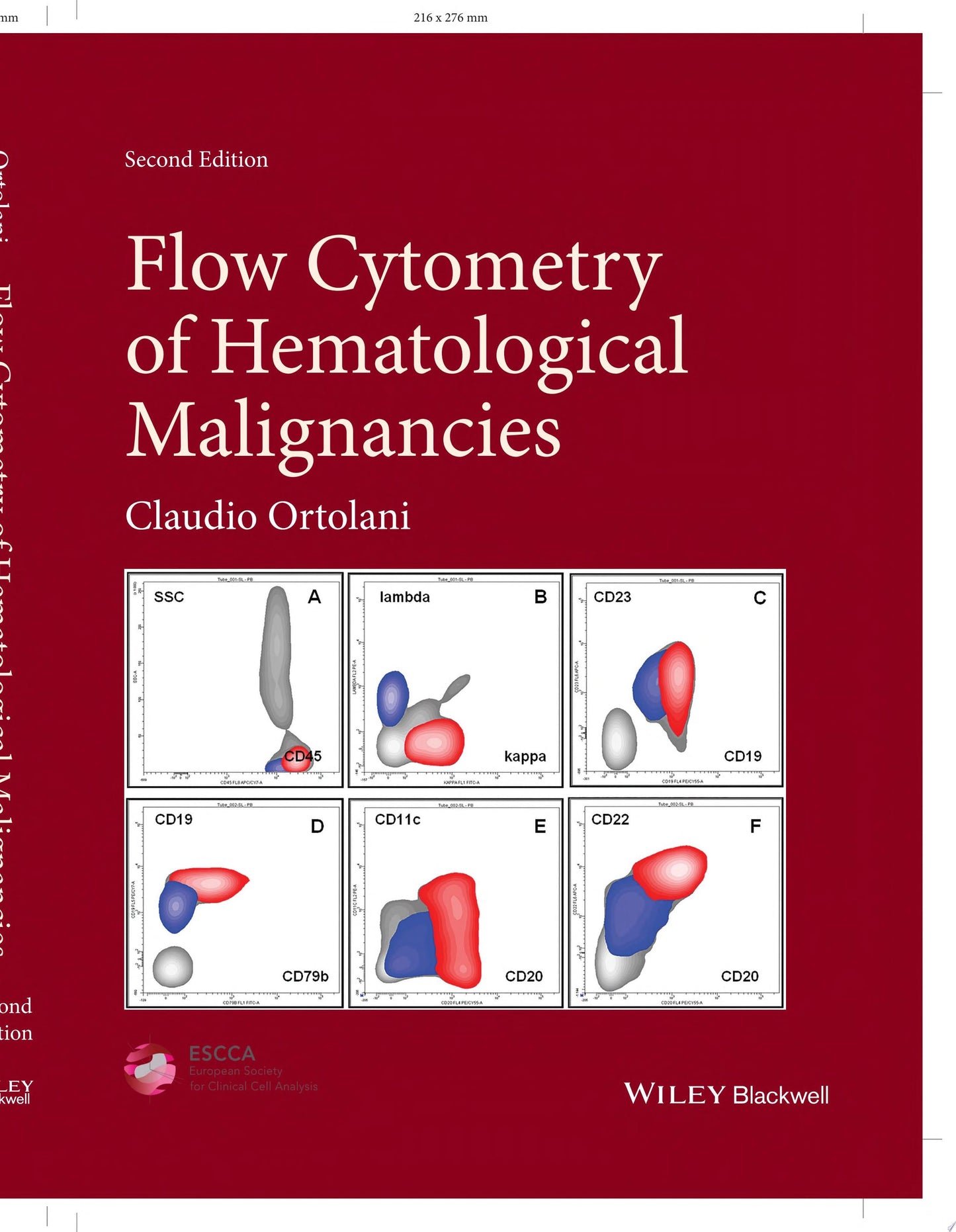 Flow Cytometry of Hematological Malignancies