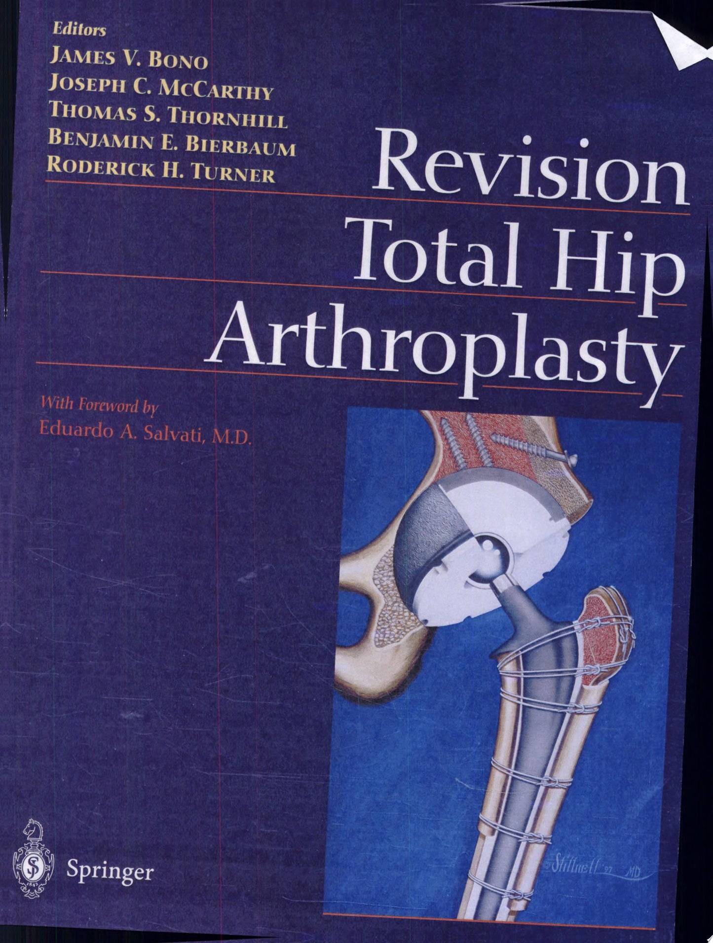 Hip Arthroplasty