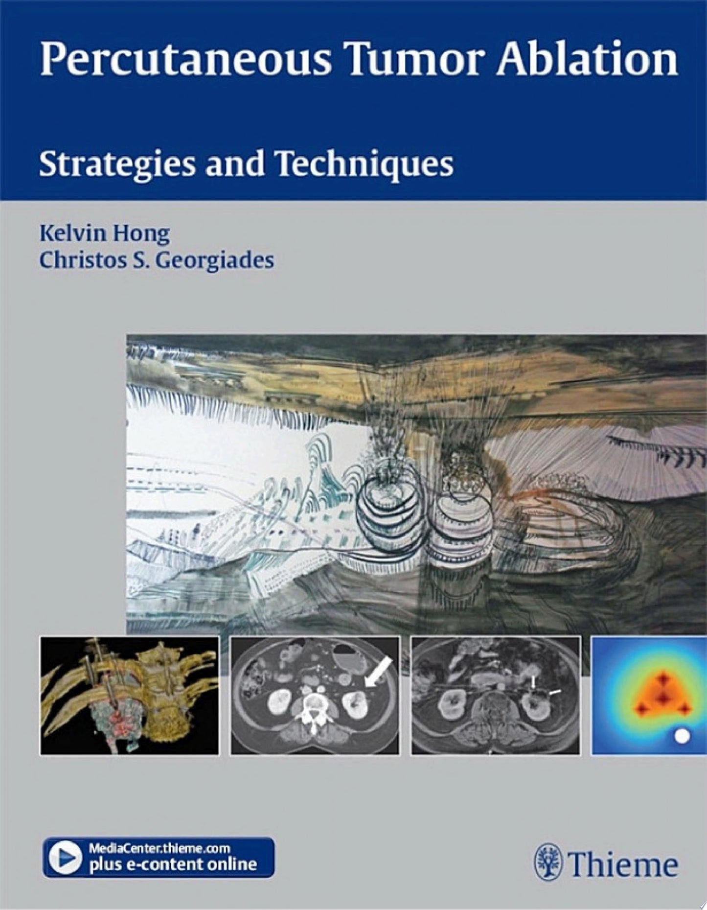 Percutaneous Tumor Ablation: Strategies and Techniques