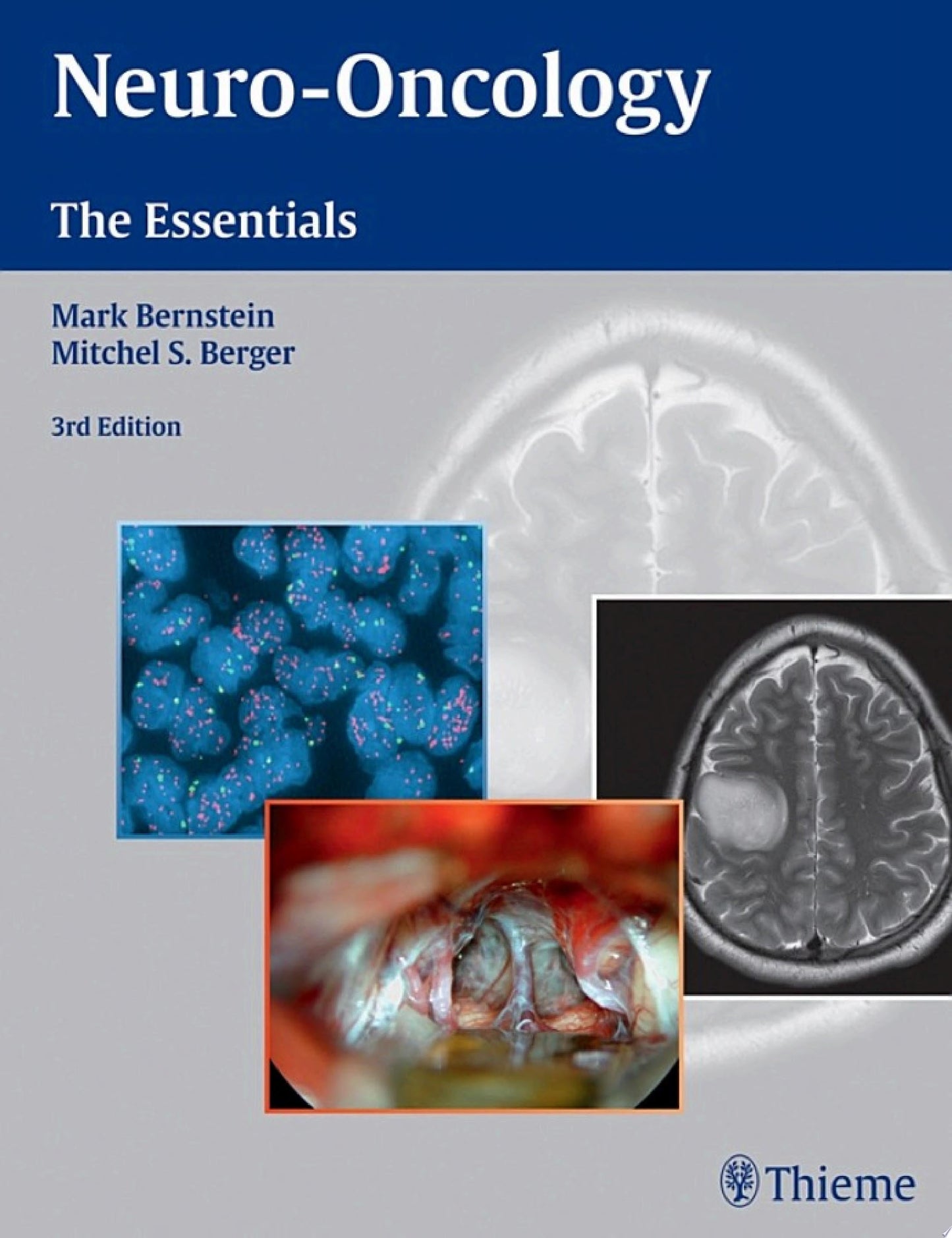 Neuro-Oncology: The Essentials, 3rd Edition