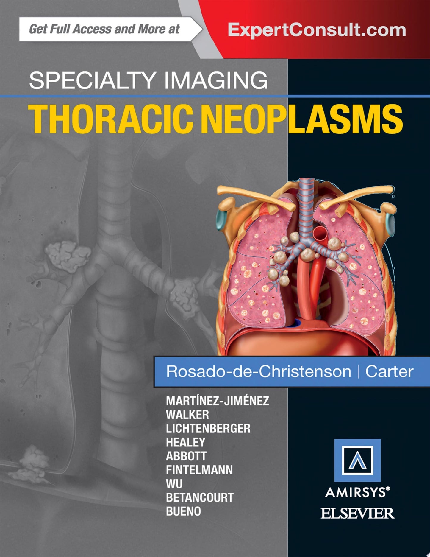 Specialty Imaging: Thoracic Neoplasms