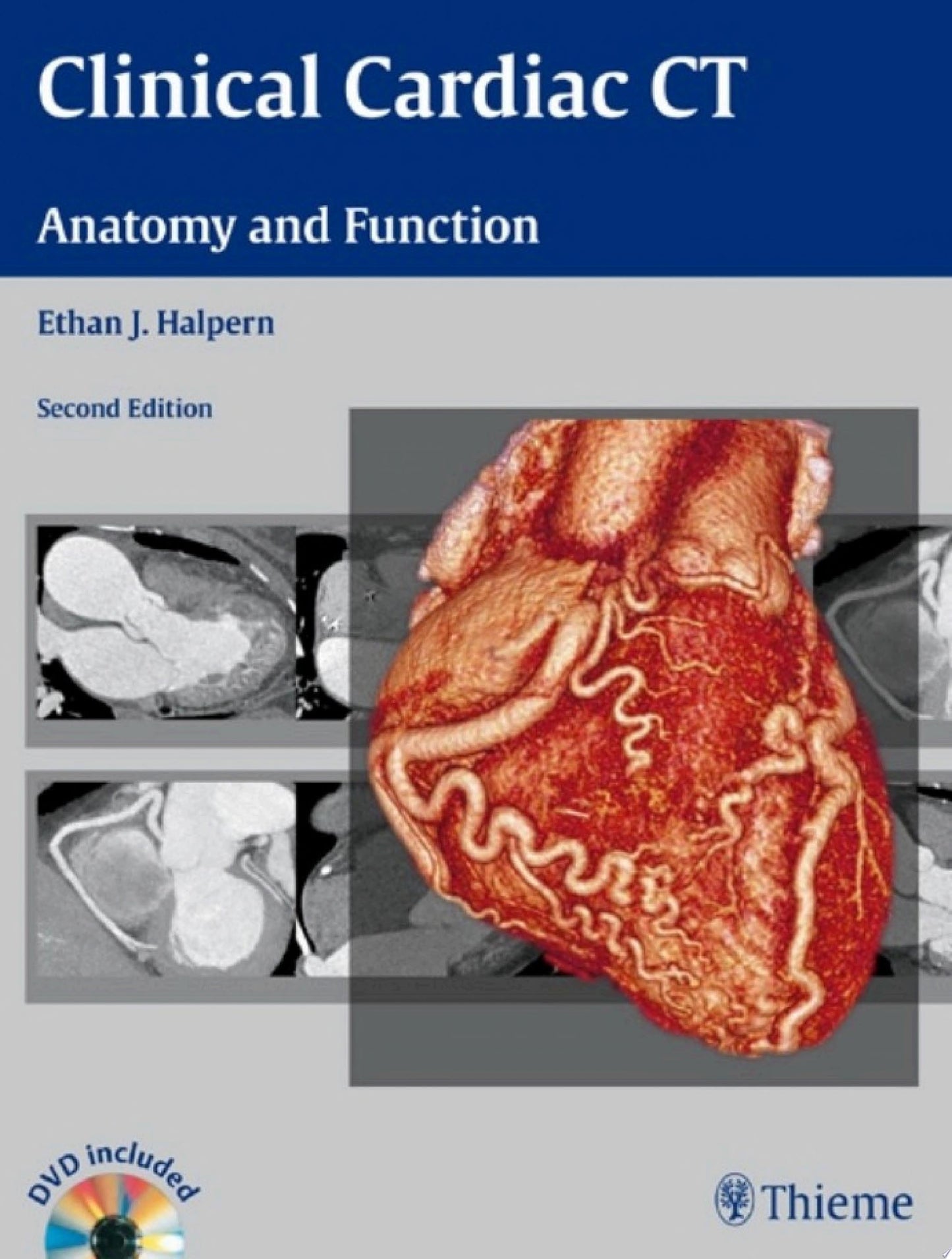 Clinical Cardiac CT: Anatomy and Function, 2nd Edition