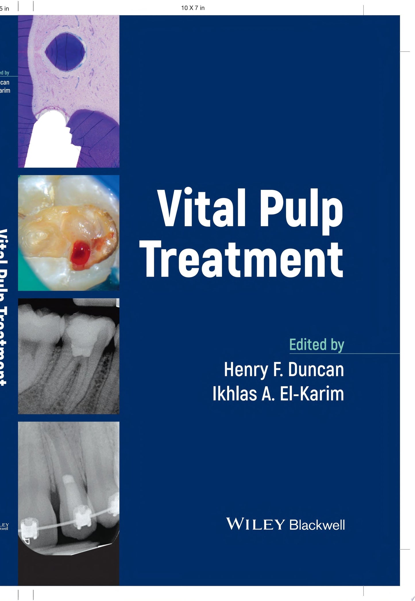 Vital Pulp Treatment