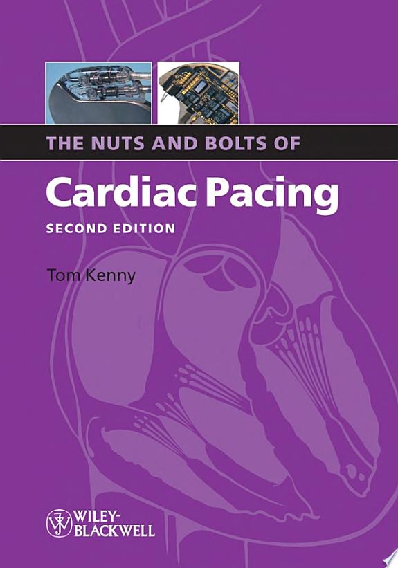 The Nuts and Bolts of Cardiac Pacing, 2nd Edition