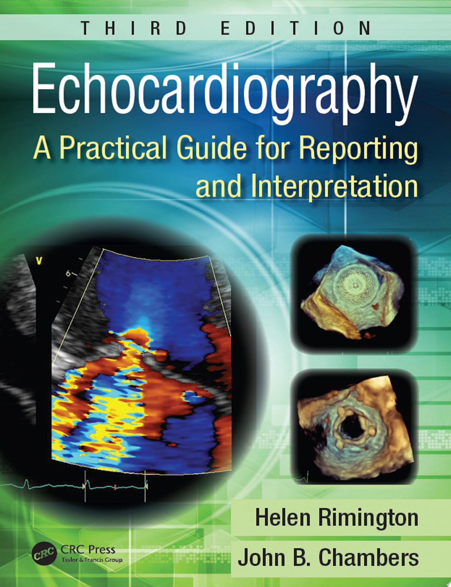 Echocardiography: A Practical Guide for Reporting and Interpretation, 4th Edition