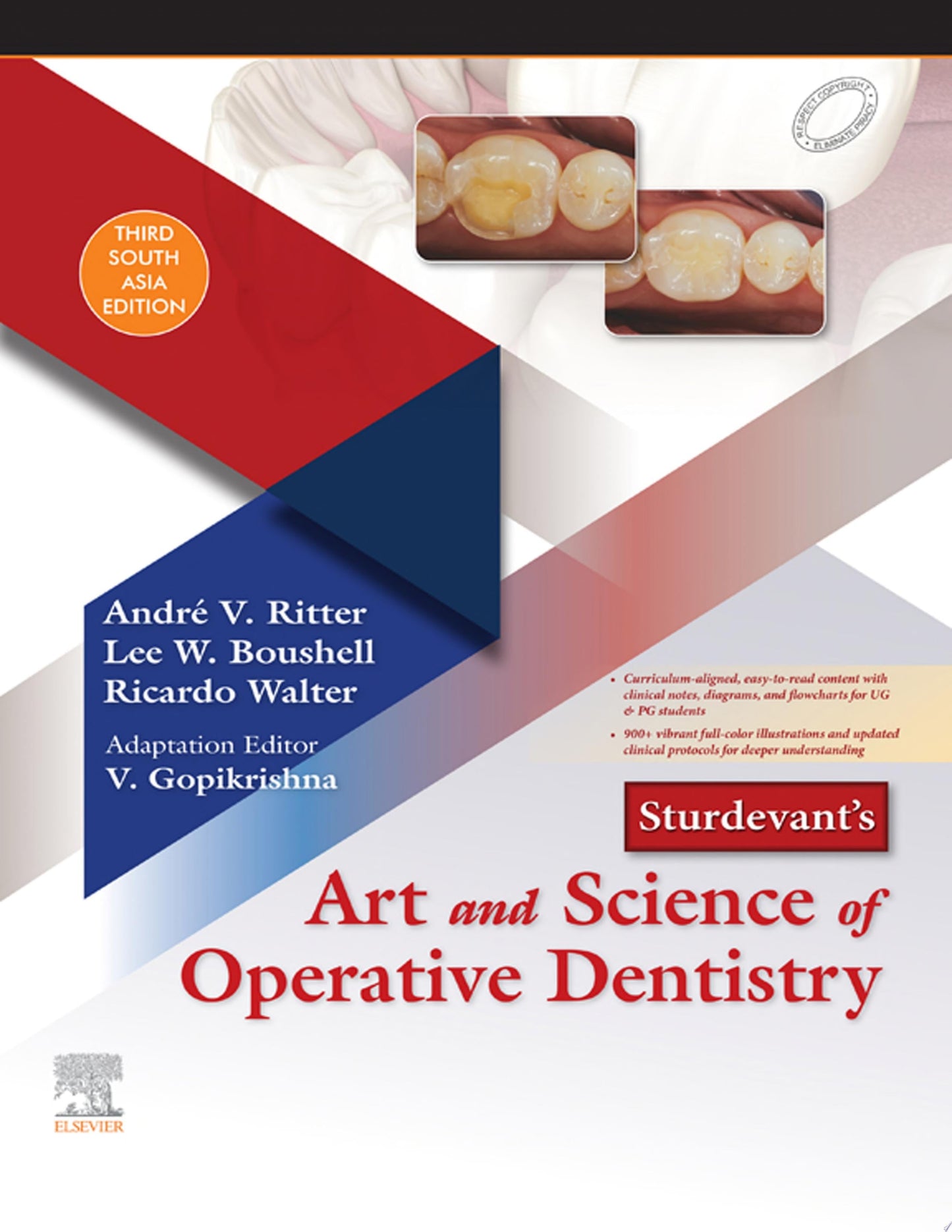 Sturdevant's Art and Science of Operative Dentistry - E-Book