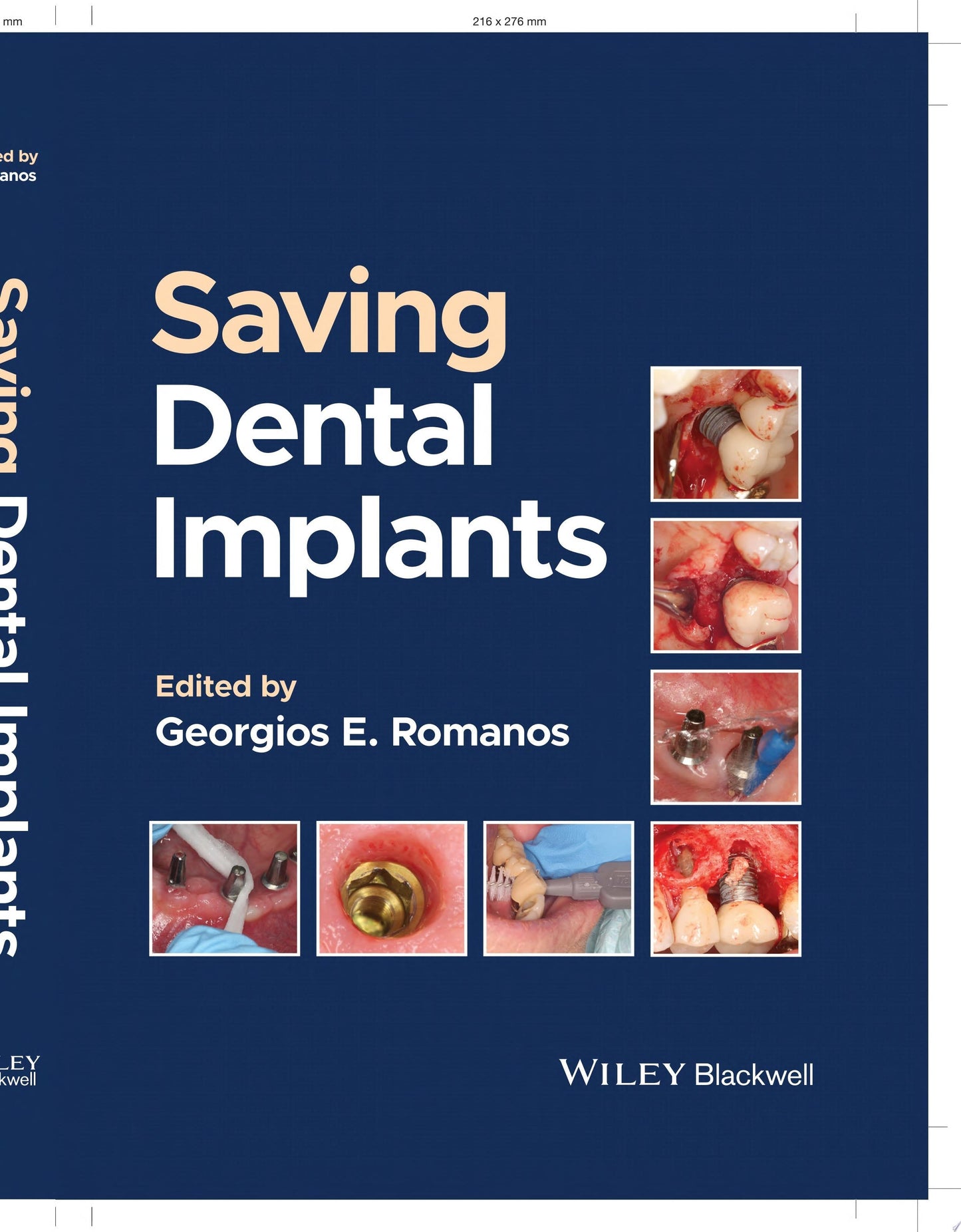 Saving Dental Implants