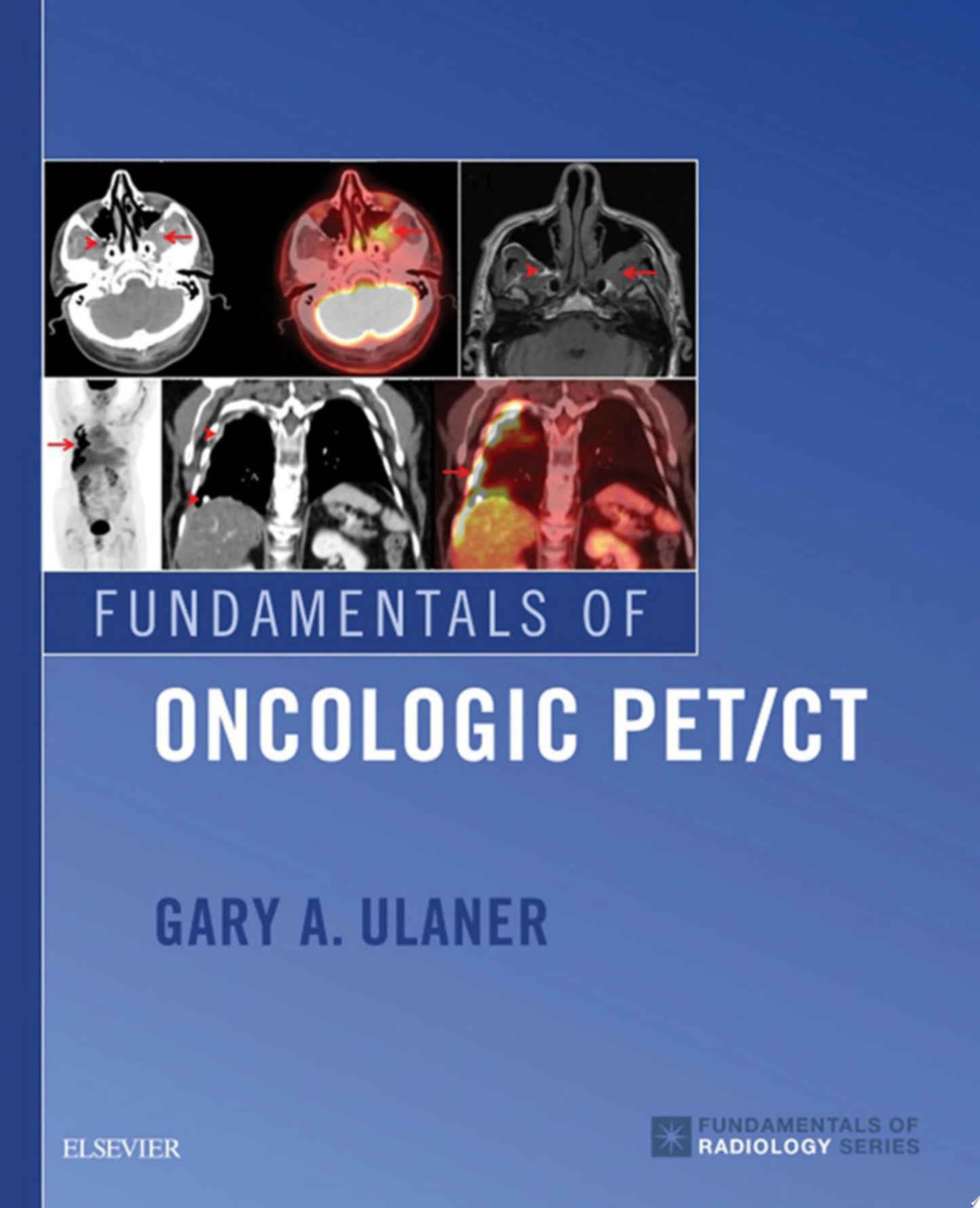 Fundamentals of Oncologic PET/CT