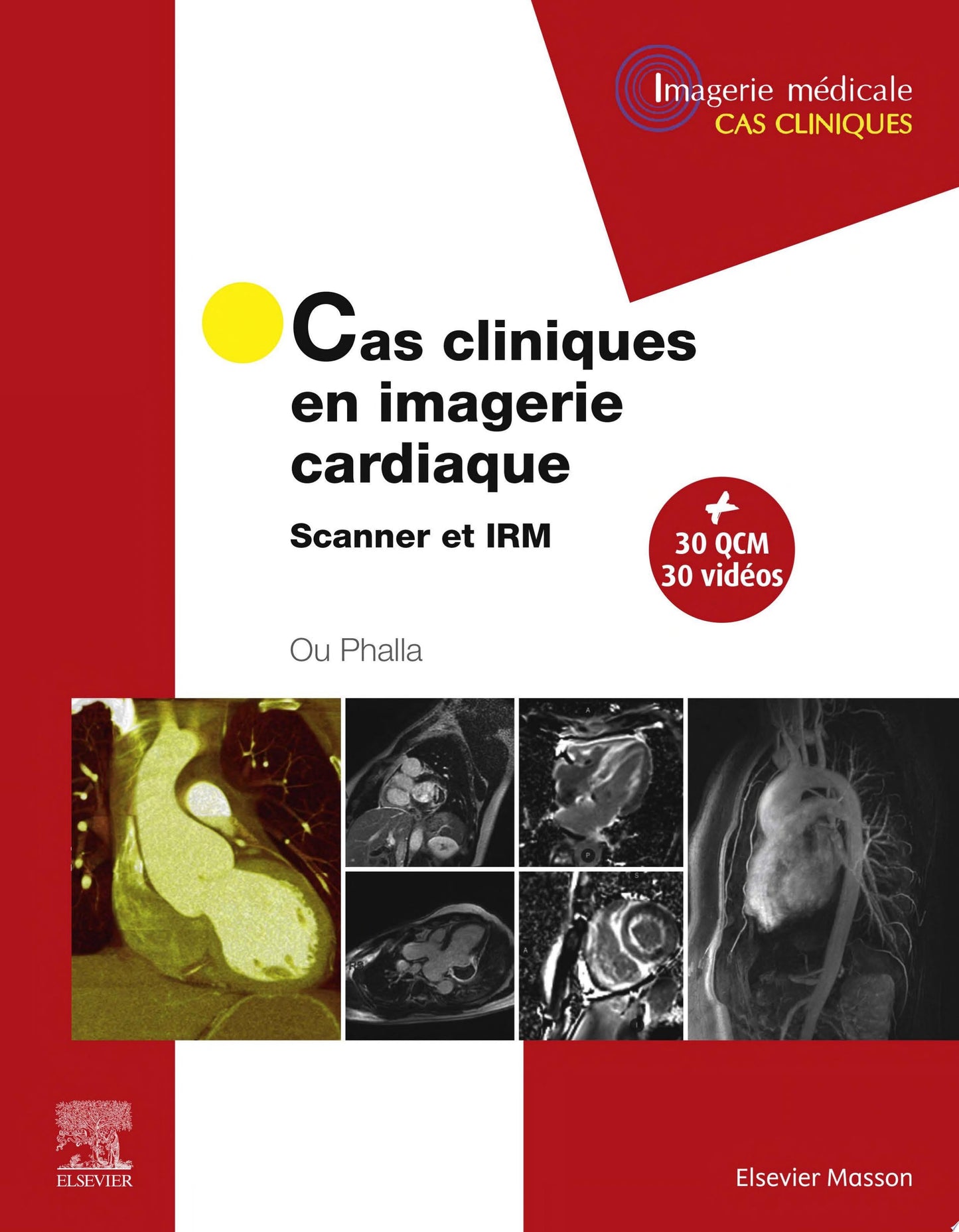 Cas cliniques en imagerie cardiaque: Scanner et IRM