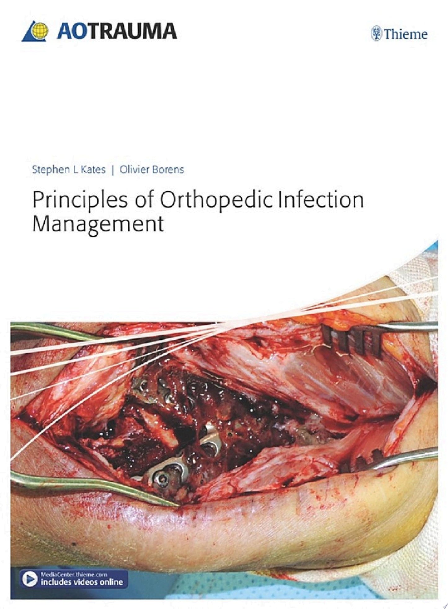 Principles of Orthopedic Infection Management (PDF)