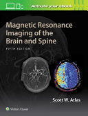Magnetic Resonance Imaging of the Brain and Spine, 5th Edition