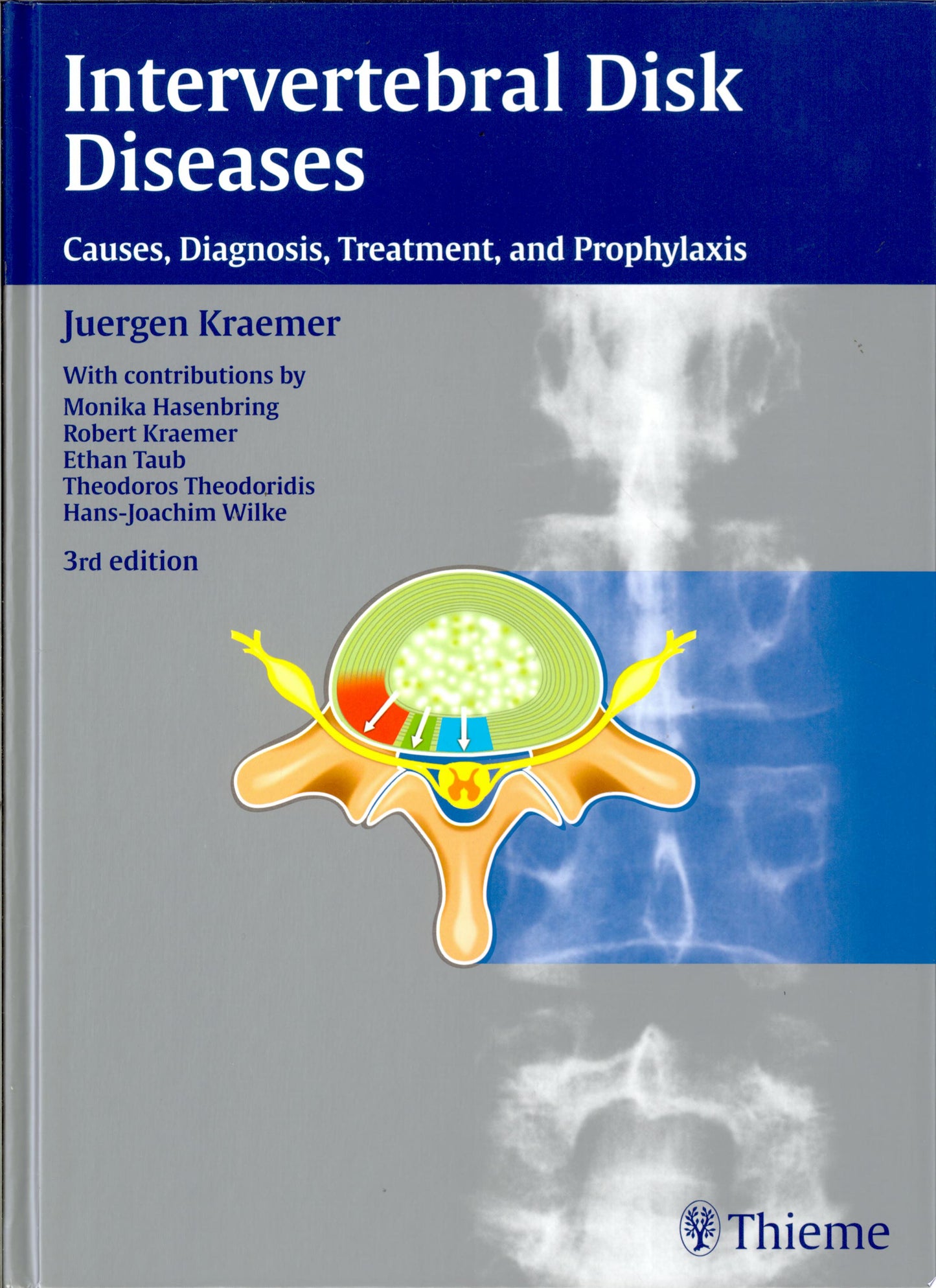 Intervertebral Disk Diseases: Causes, Diagnosis, Treatment and Prophylaxis, 3rd Edition