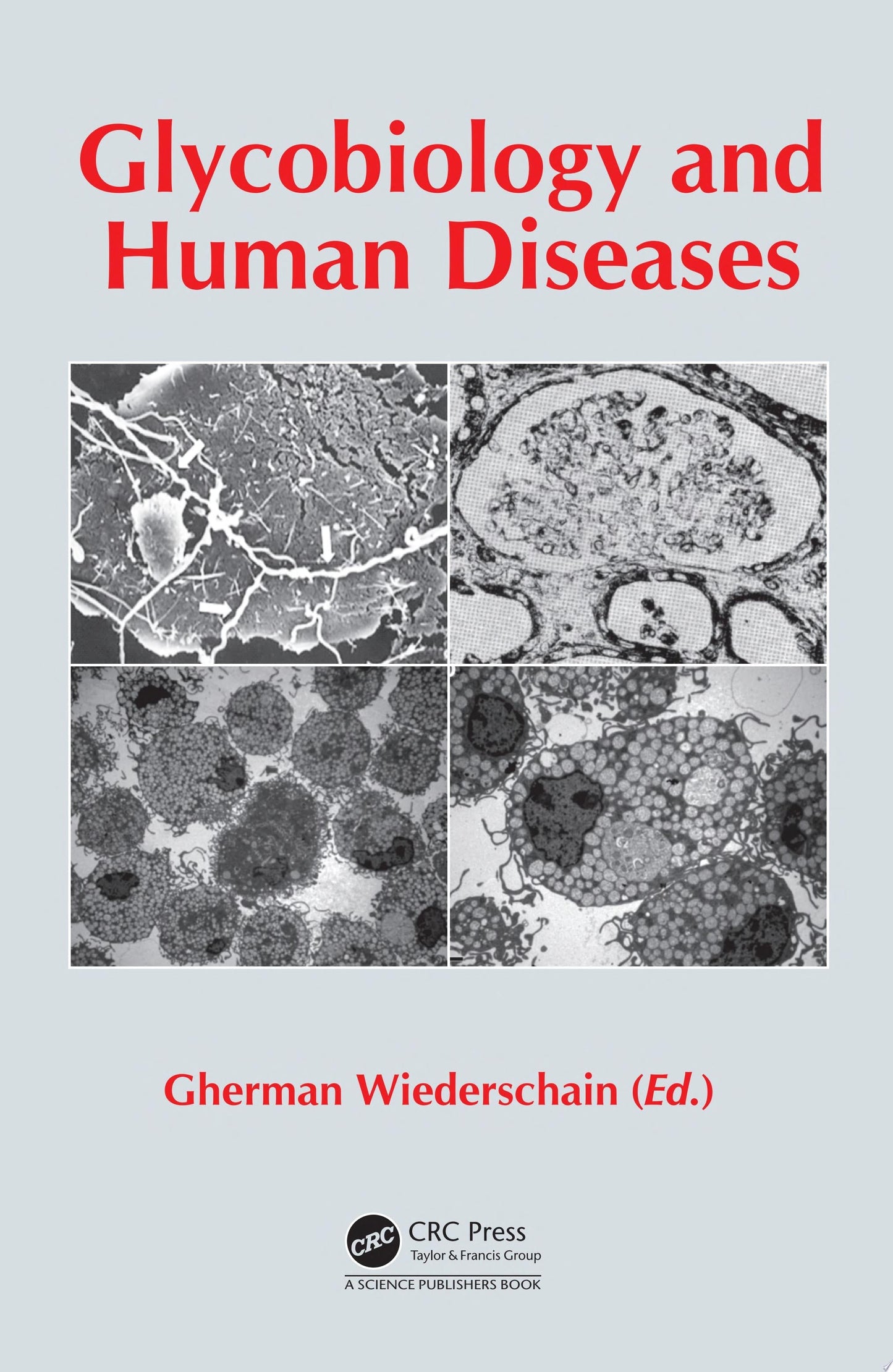 Glycobiology and Human Diseases