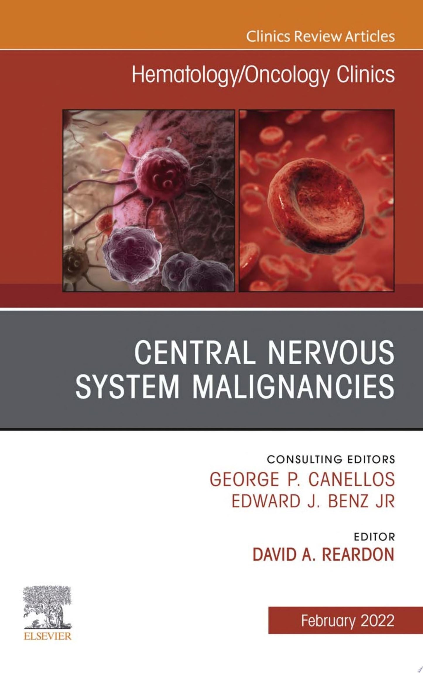 Central Nervous System Malignancies, An Issue of Hematology/Oncology Clinics of North America