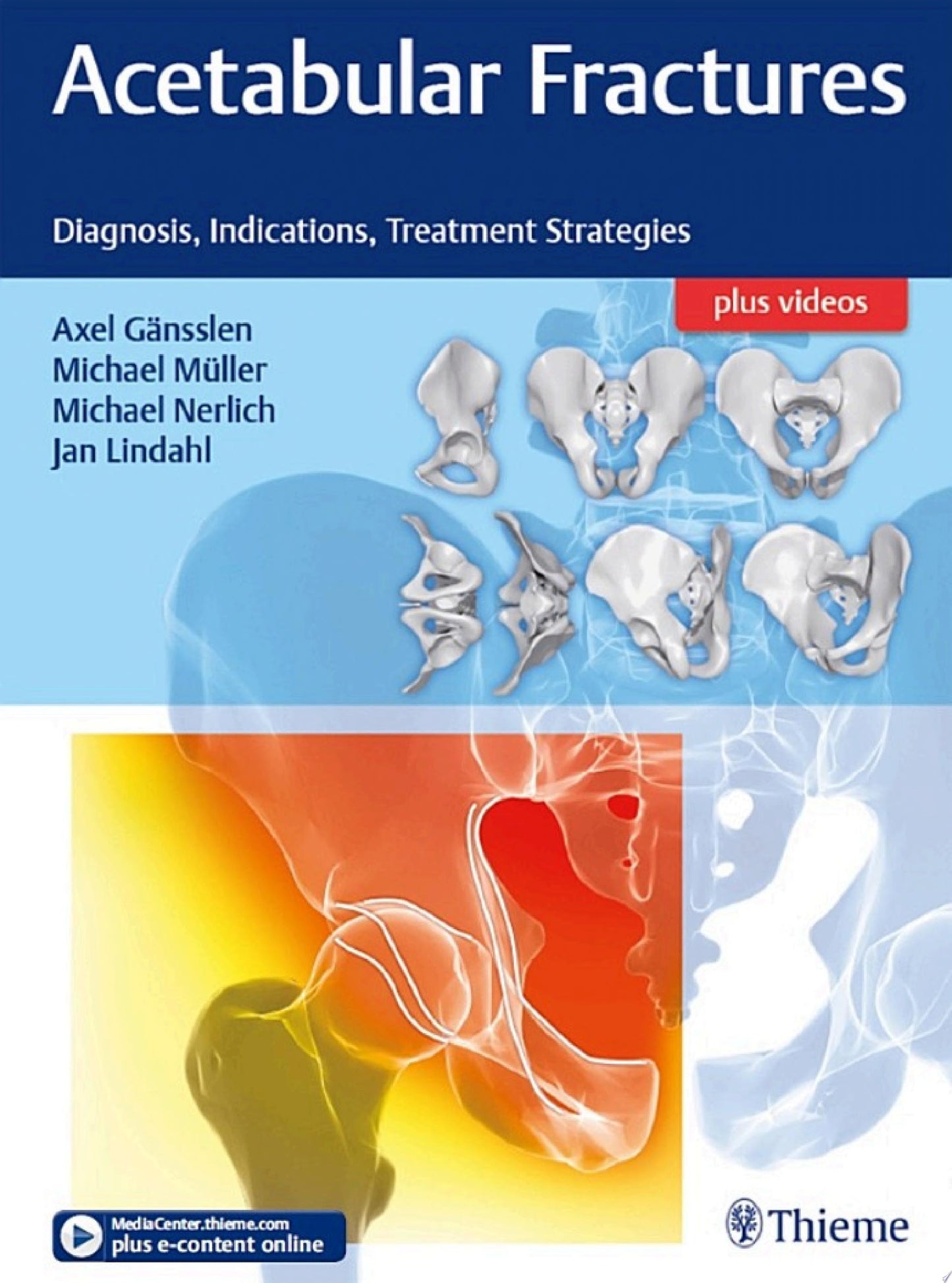 Acetabular Fractures: Diagnosis, Indications, Treatment Strategies (PDF)