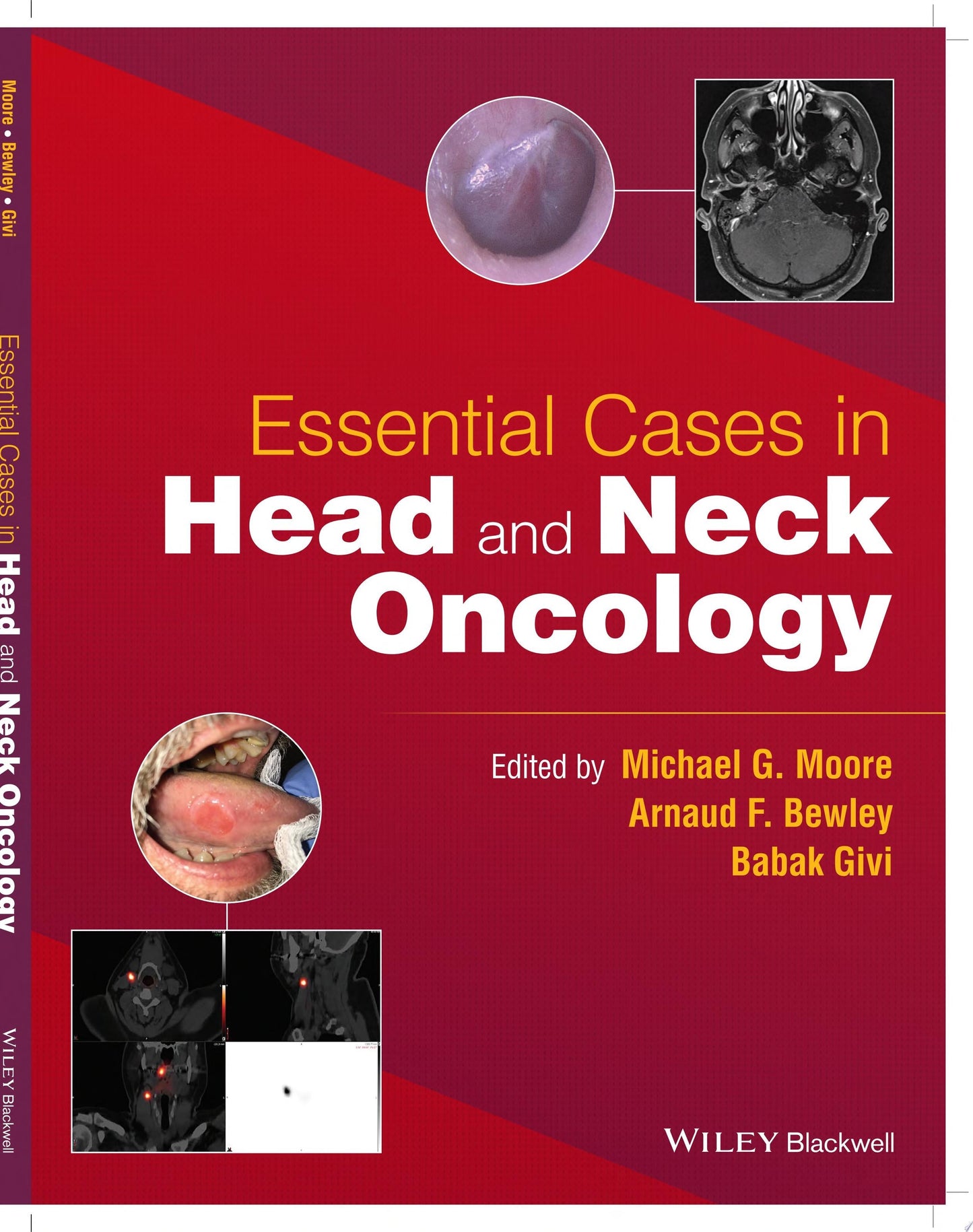 Essential Cases in Head and Neck Oncology