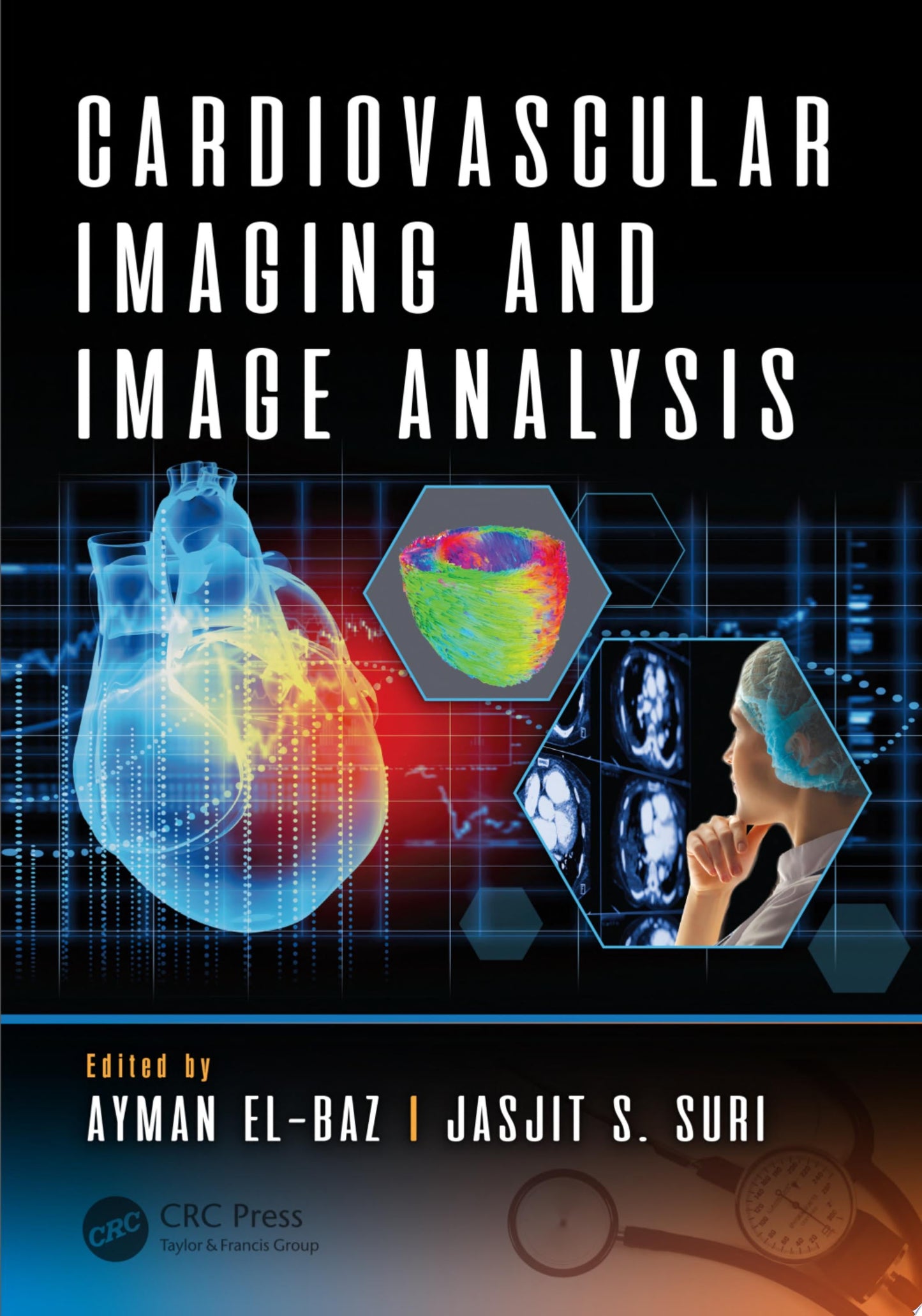 Cardiac Ultrasound