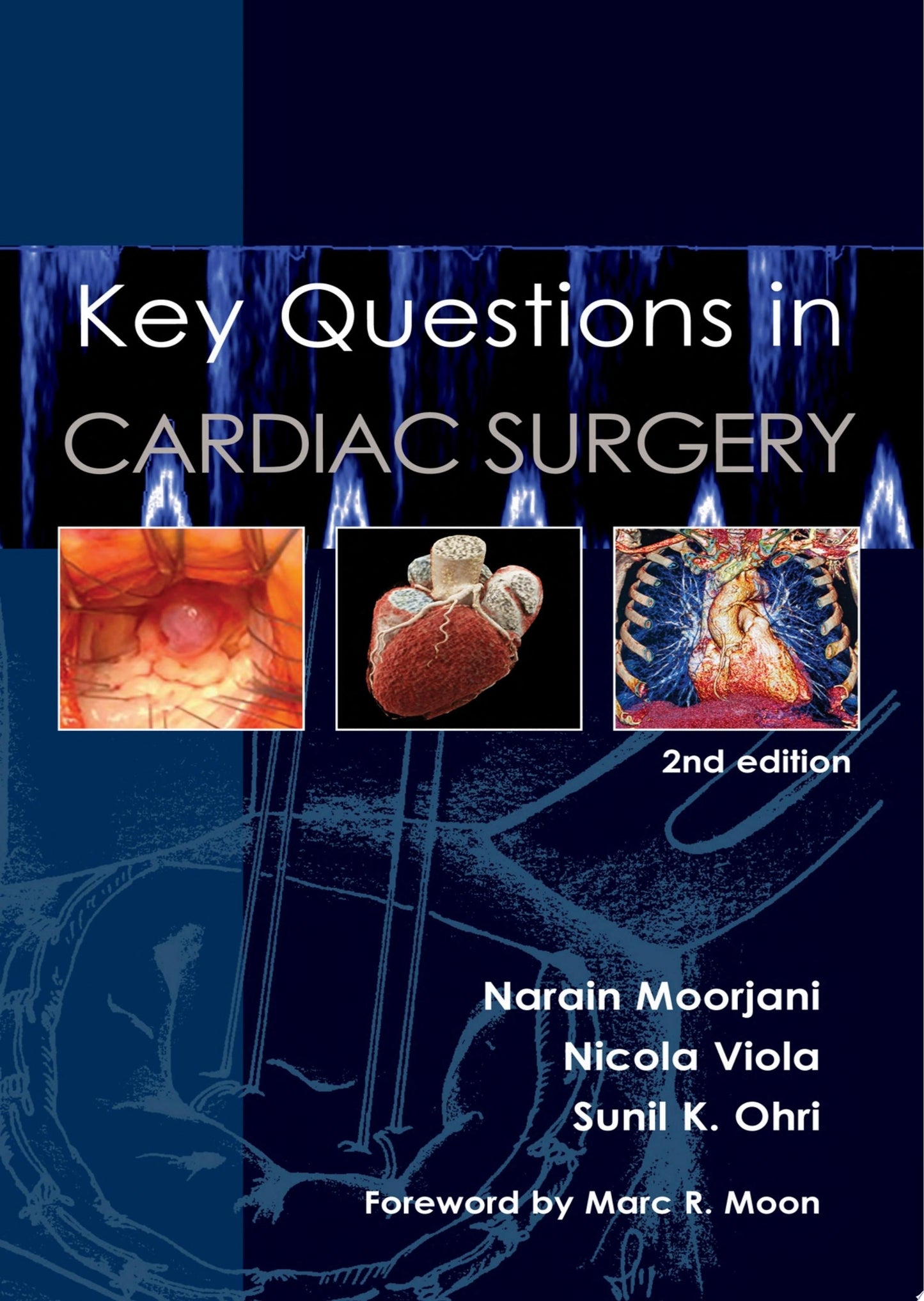 Near Misses in Cardiac Surgery, 2nd Edition