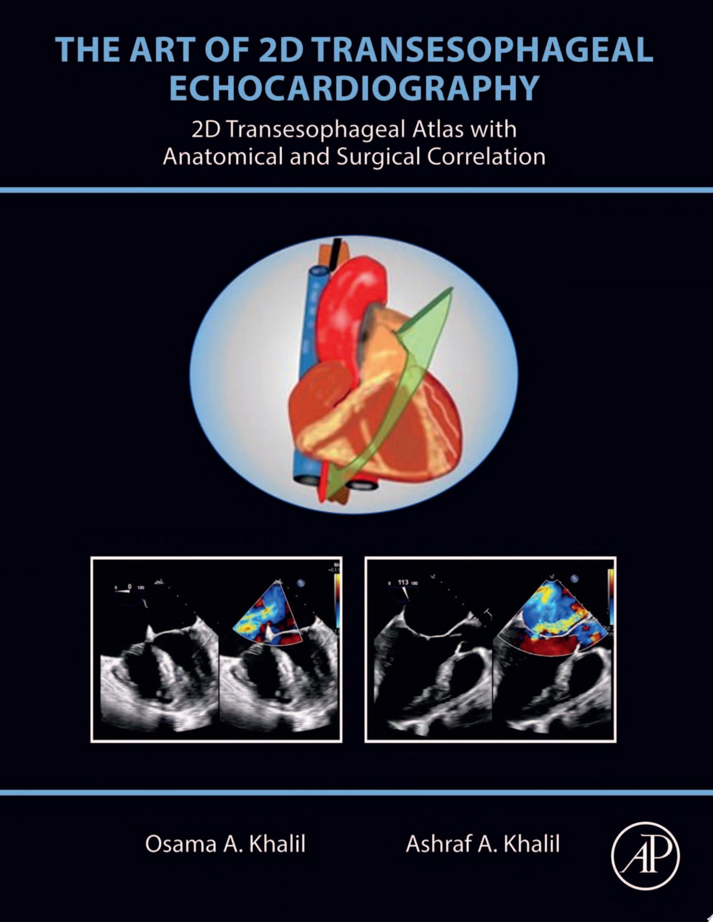 The Art of 2D Transesophageal Echocardiography: 2D Transesophageal Atlas with Anatomical and Surgical Correlation