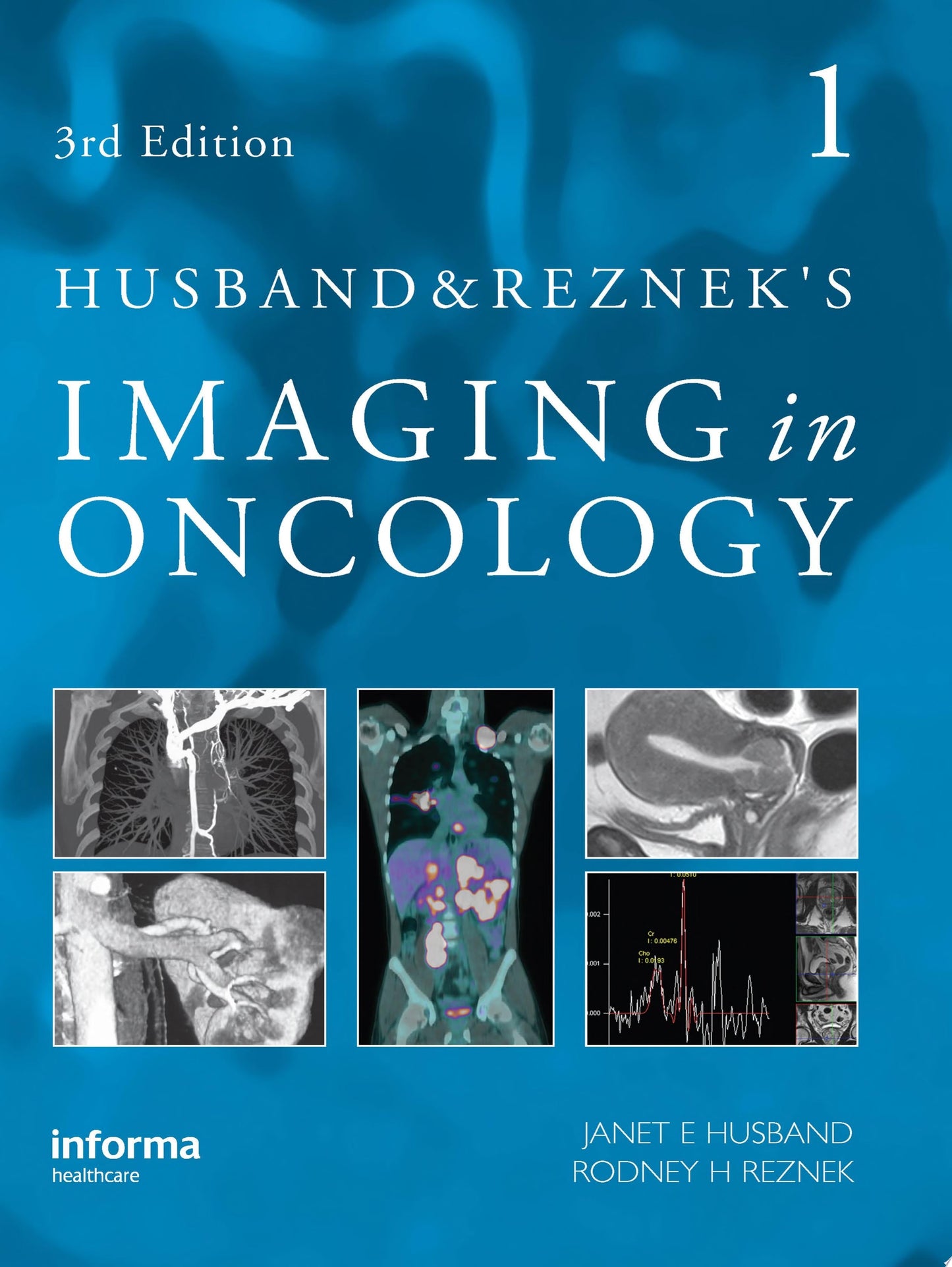 Husband & Reznek’s Imaging in Oncology, 4th edition