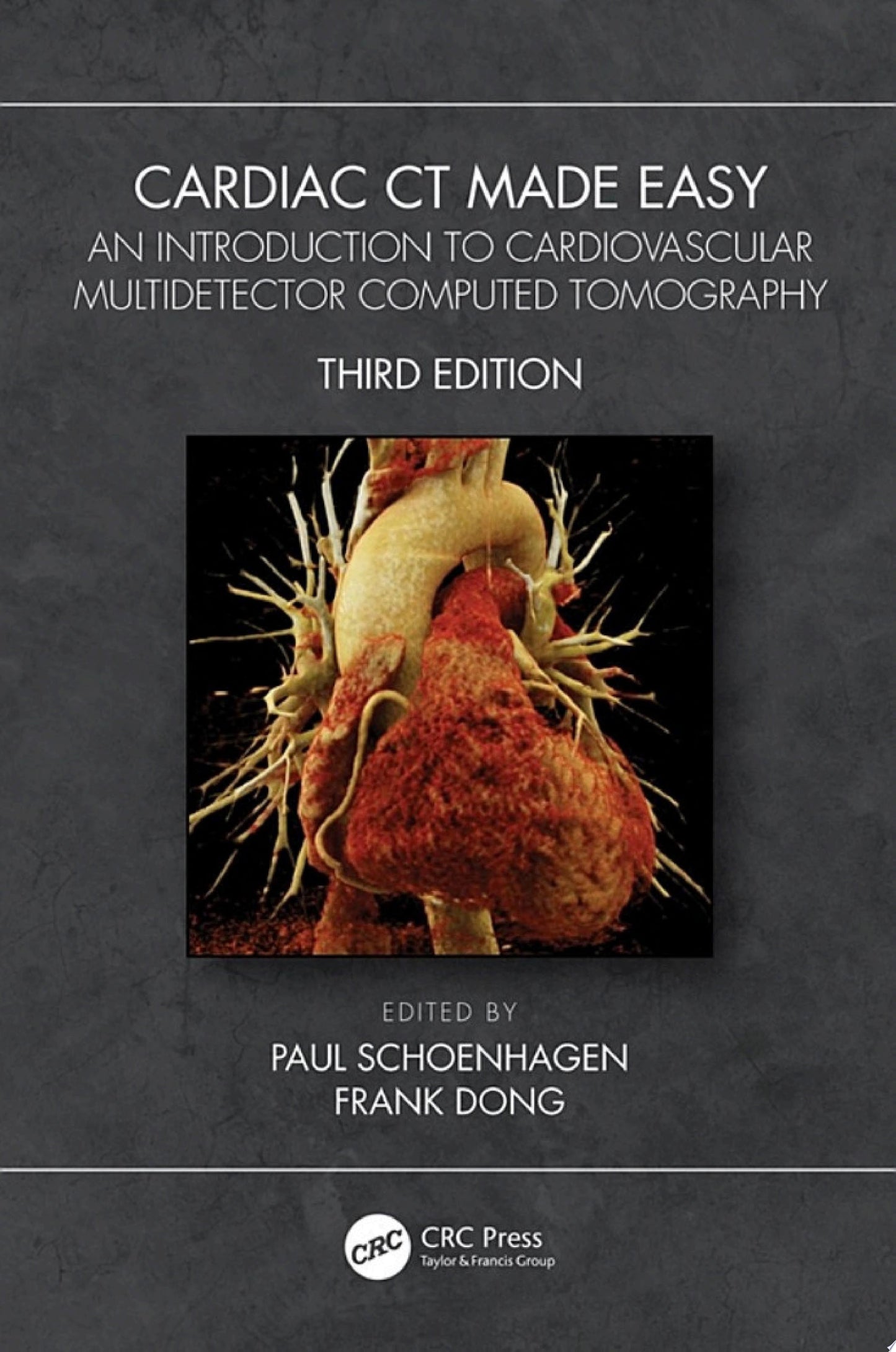 Cardiac CT Made Easy: An Introduction to Cardiovascular Multidetector Computed Tomography, 3rd Edition