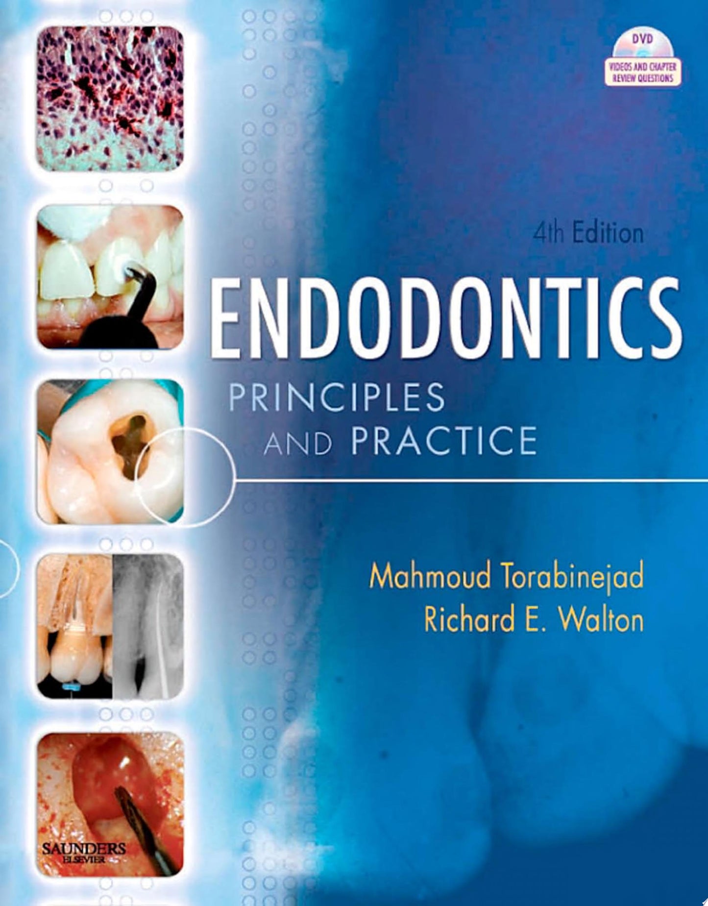 Endodontics - E-Book