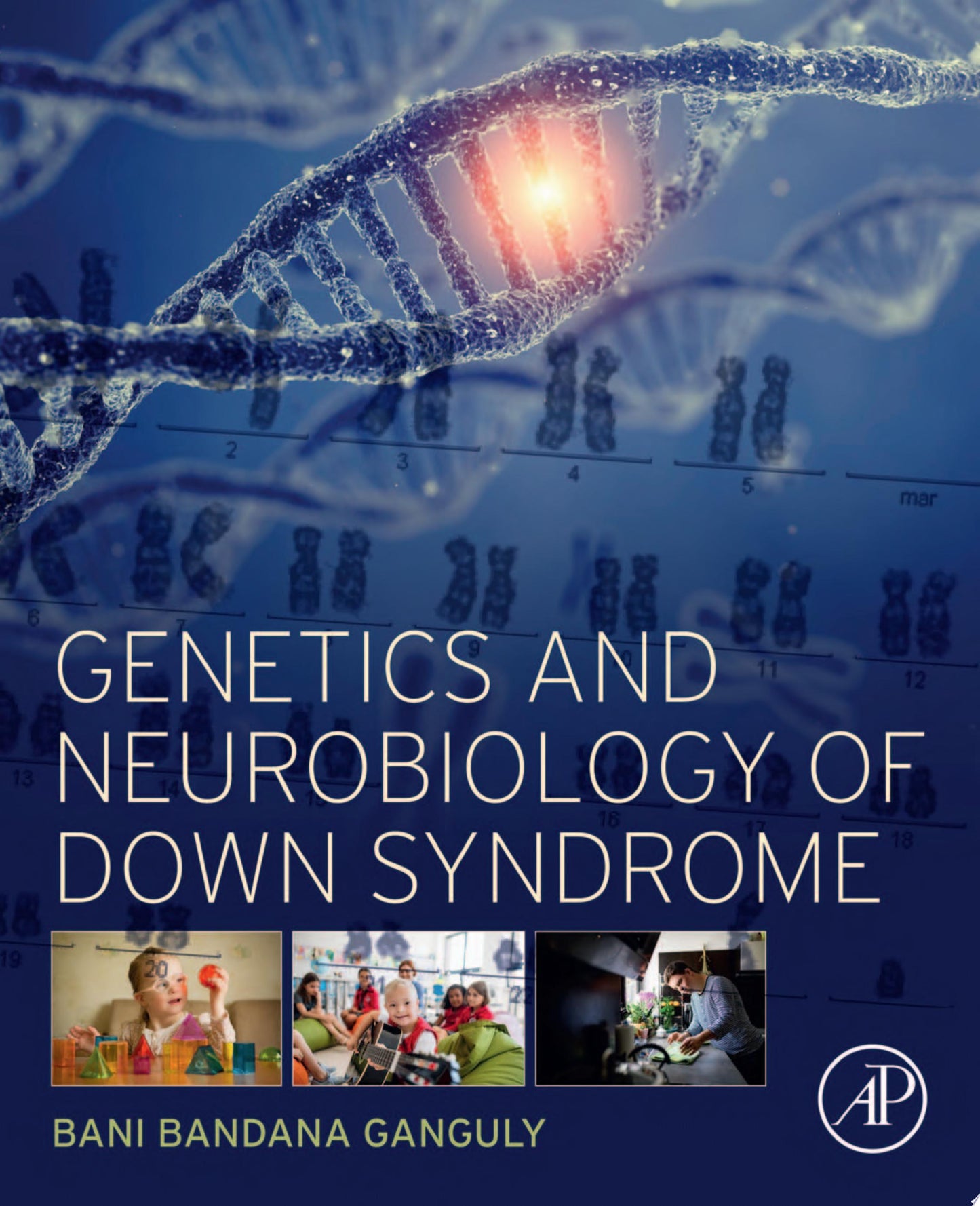 Genetics and Neurobiology of Down Syndrome