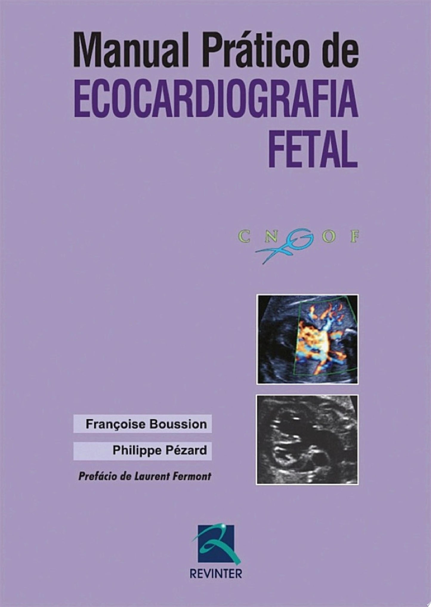 Manual Prático de Ecocardiografia Fetal, 1st Edition