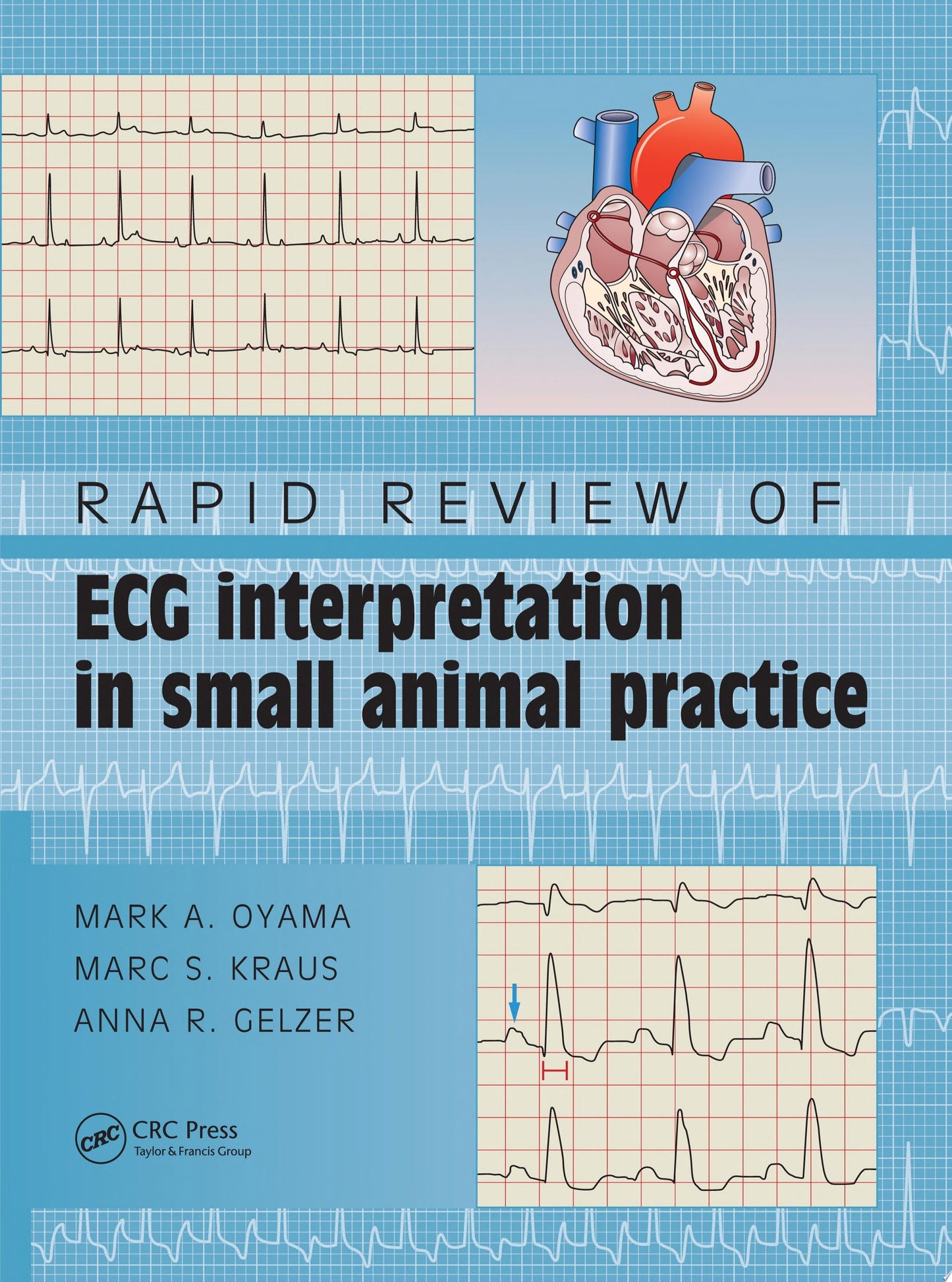 Rapid Review of ECG Interpretation