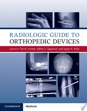 Radiologic Guide to Orthopedic Devices, 1e (ORIGINAL PDF from Publisher)