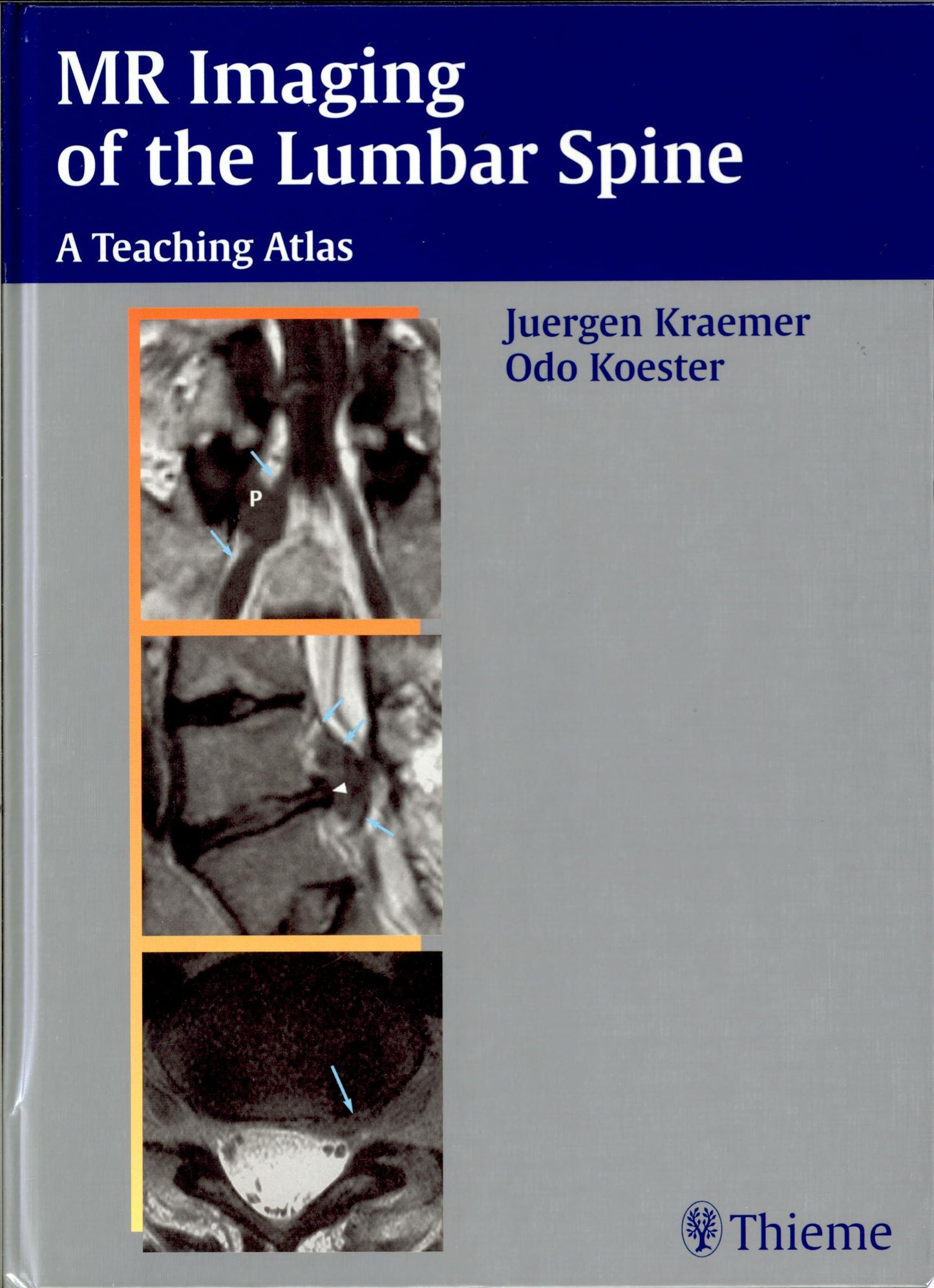 MR Imaging of the Lumbar Spine (ORIGINAL PDF from publisher)
