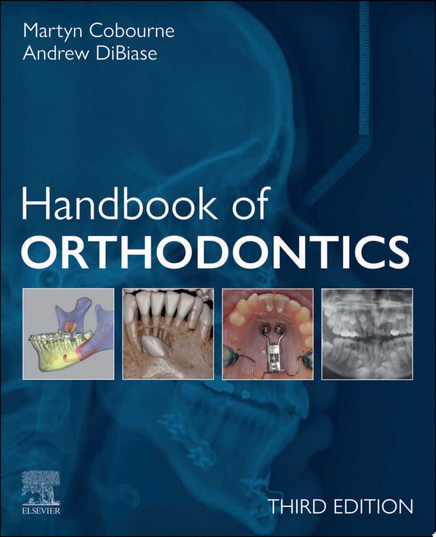 Handbook of Orthodontics E-Book