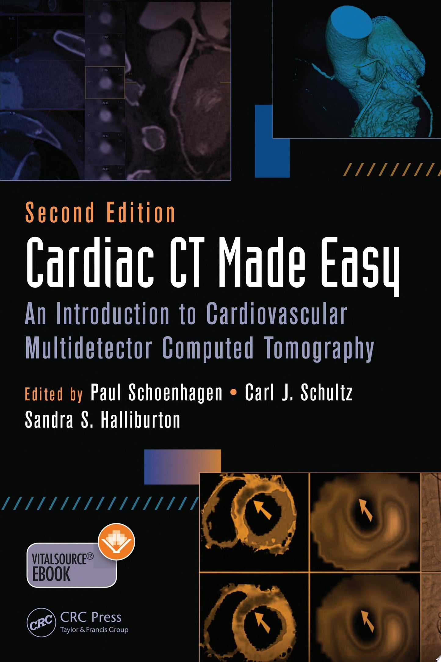 Cardiac CT Made Easy: An Introduction to Cardiovascular Multidetector Computed Tomography, Second Edition