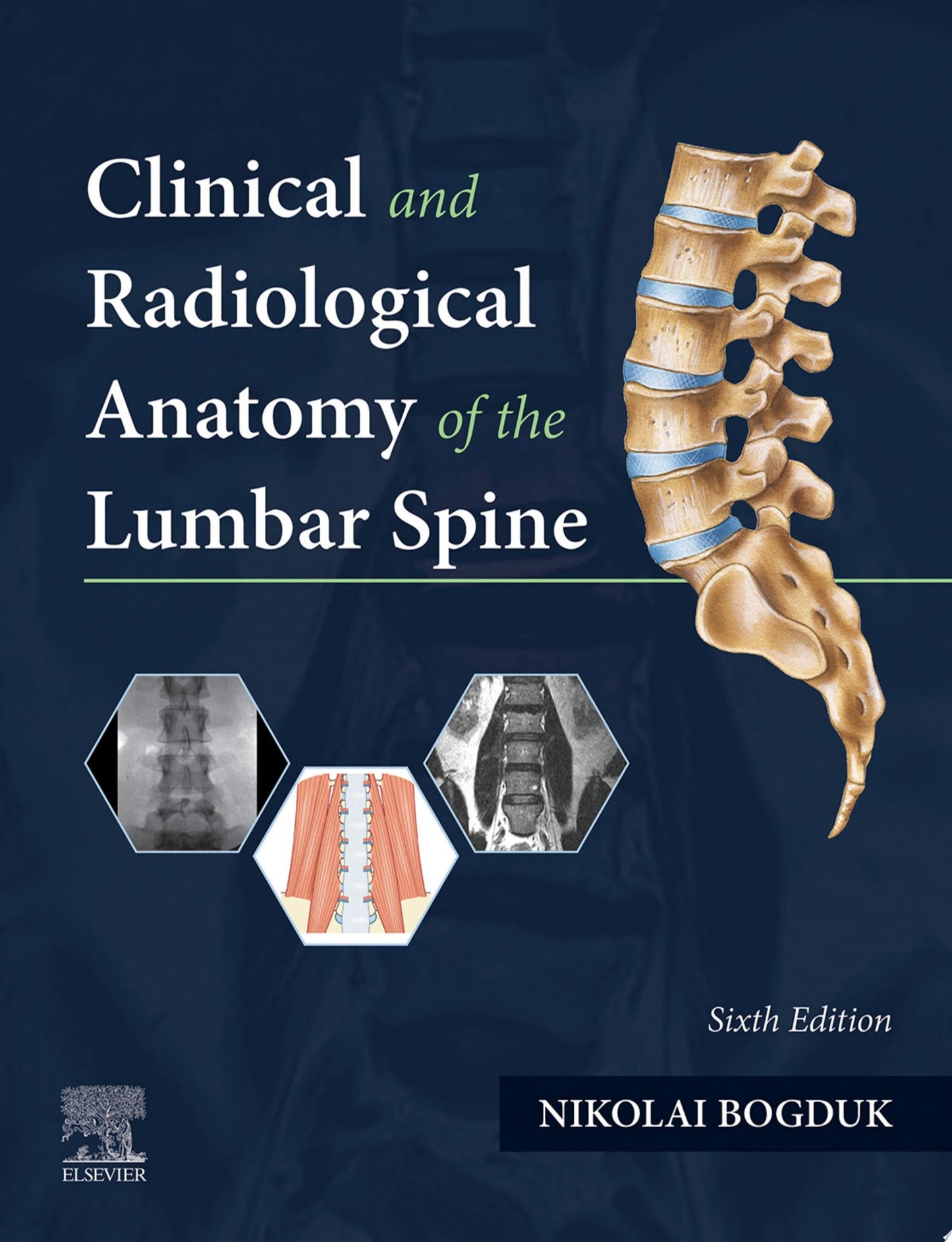 Clinical and Radiological Anatomy of the Lumbar Spine, 5th Edition (ORIGINAL PDF from Publisher)