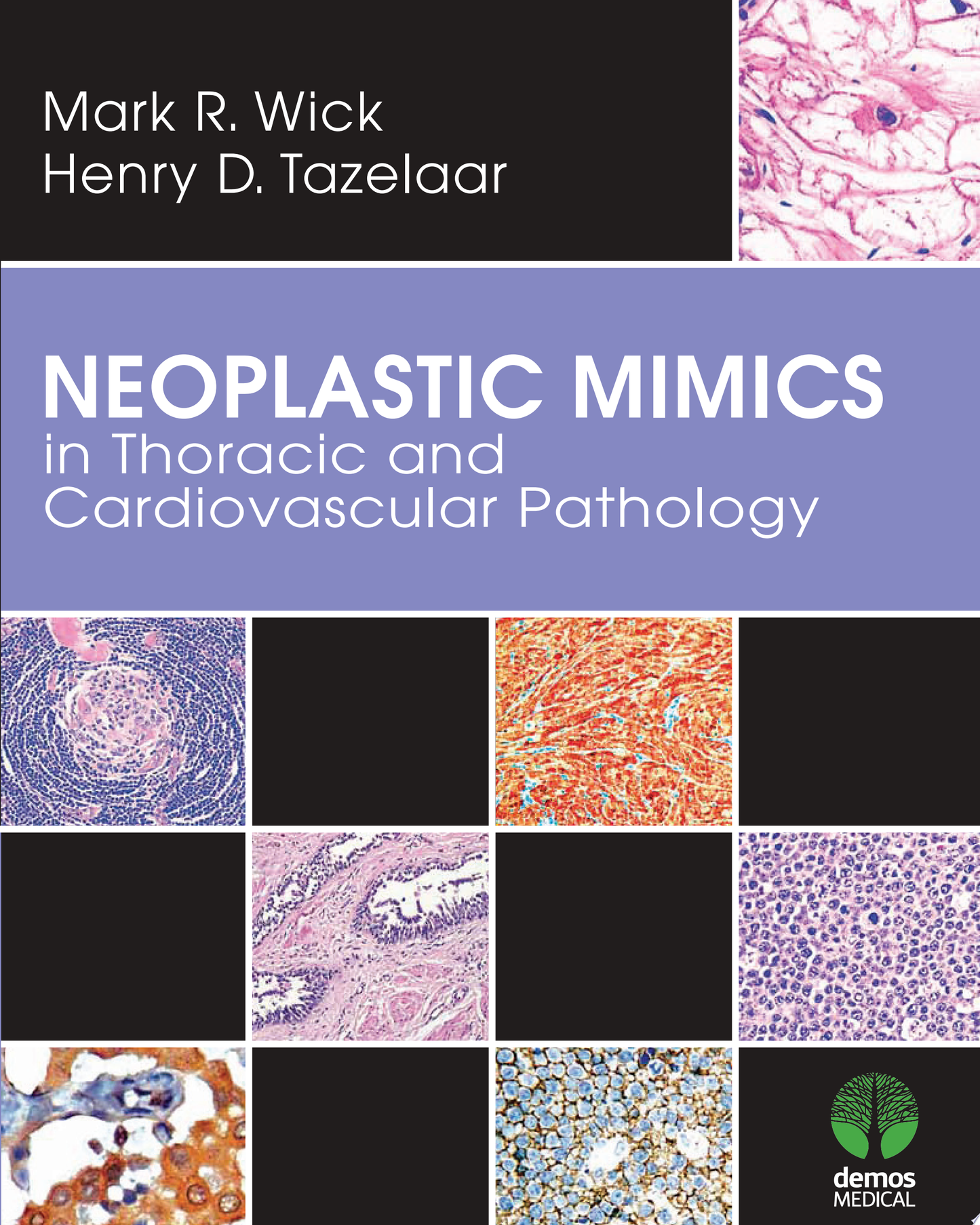 Neoplastic Mimics in Thoracic and Cardiovascular Pathology