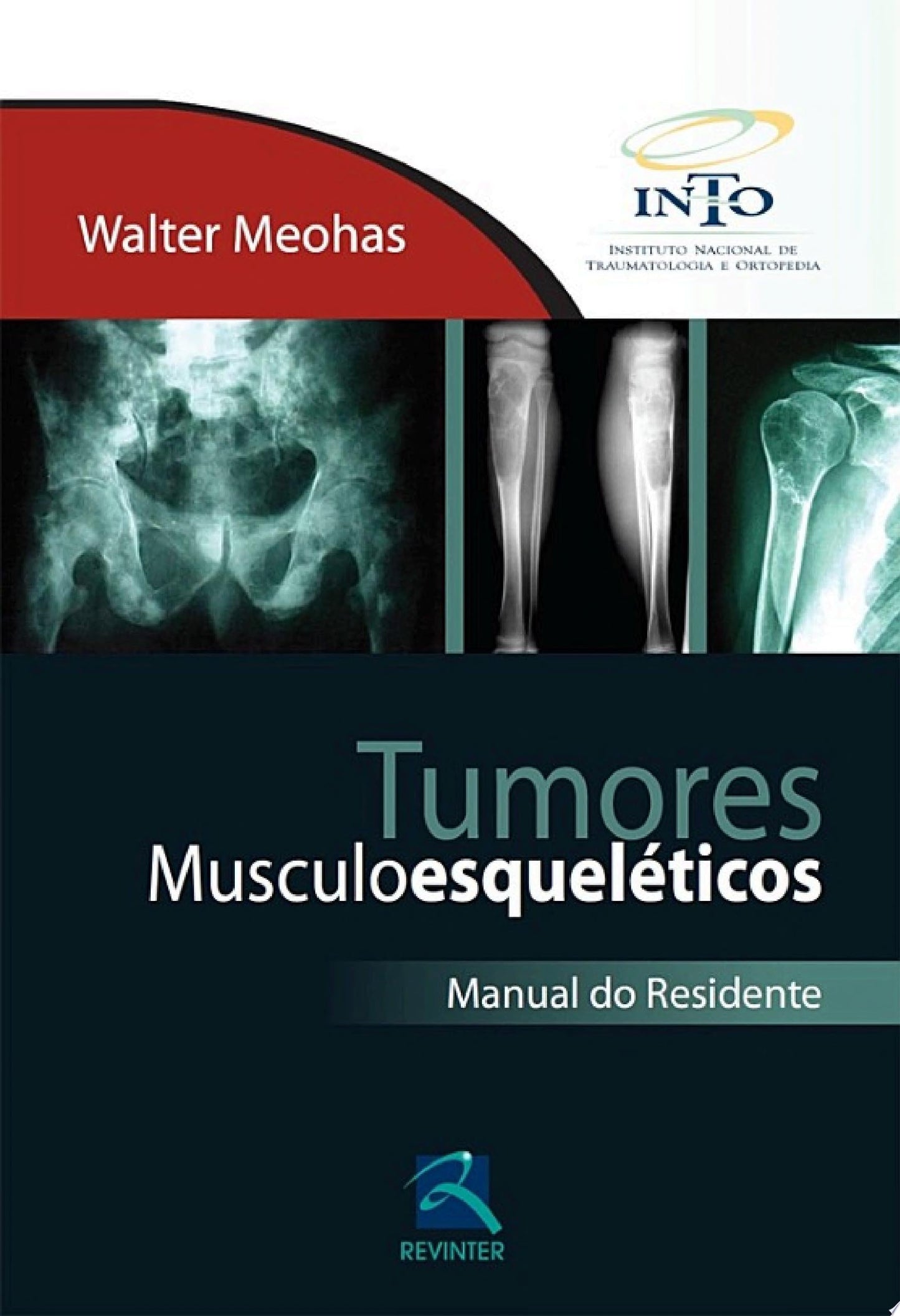 Tumores Musculoesqueléticos: Manual do Residente, 1st Edition