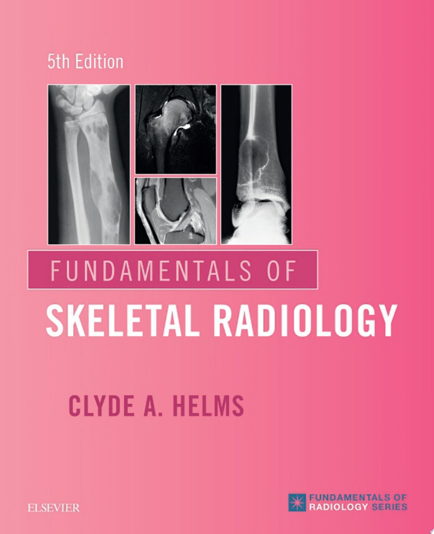 Fundamentals of Skeletal Radiology, 4th Edition