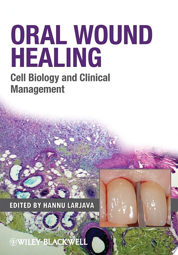 Oral Wound Healing
