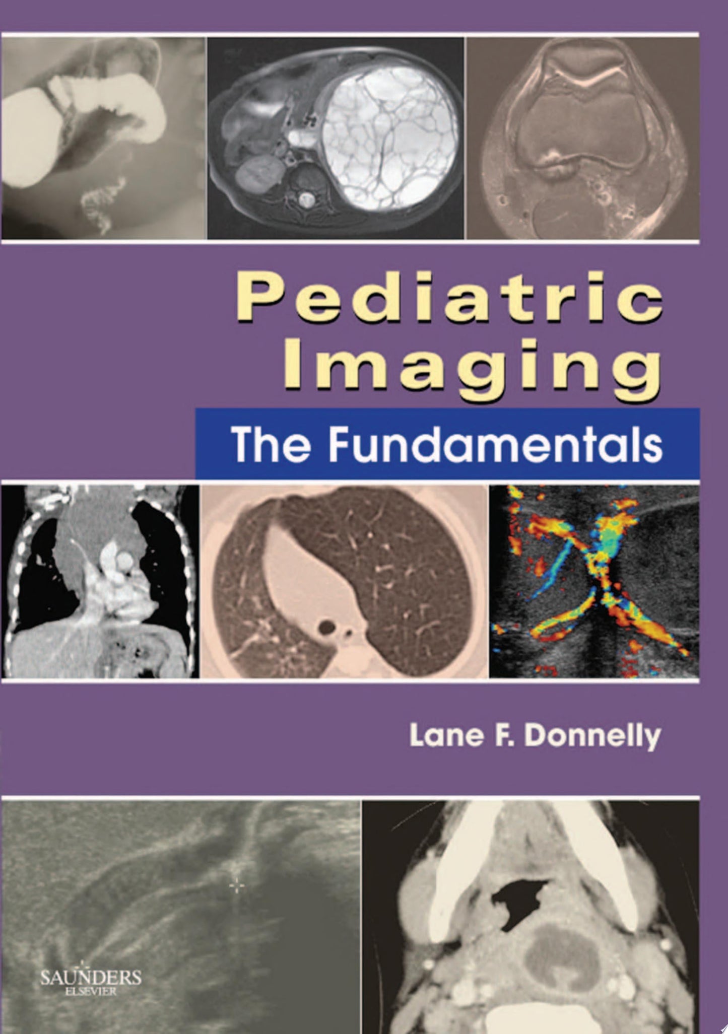 Pediatric imaging: the fundamentals E-Book
